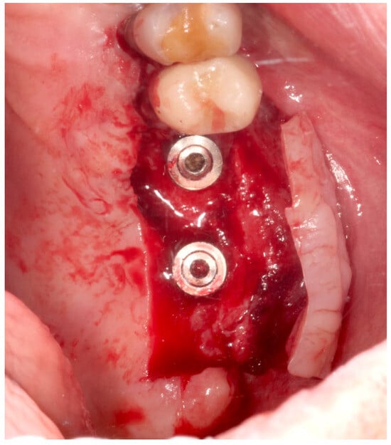 Medicina Free Full Text Evaluation of Post Operative Morbidity