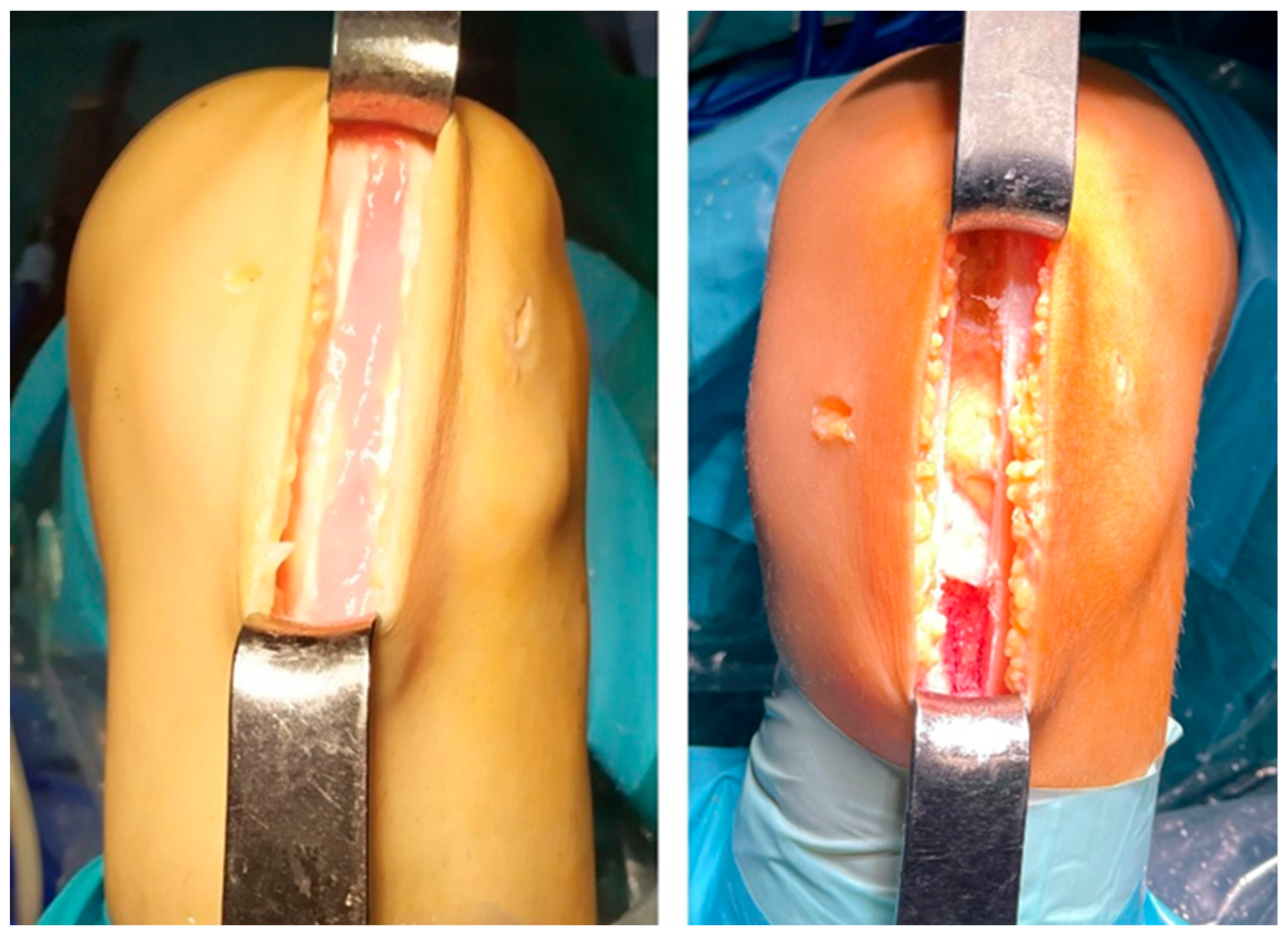 Medicina 60 00154 g002