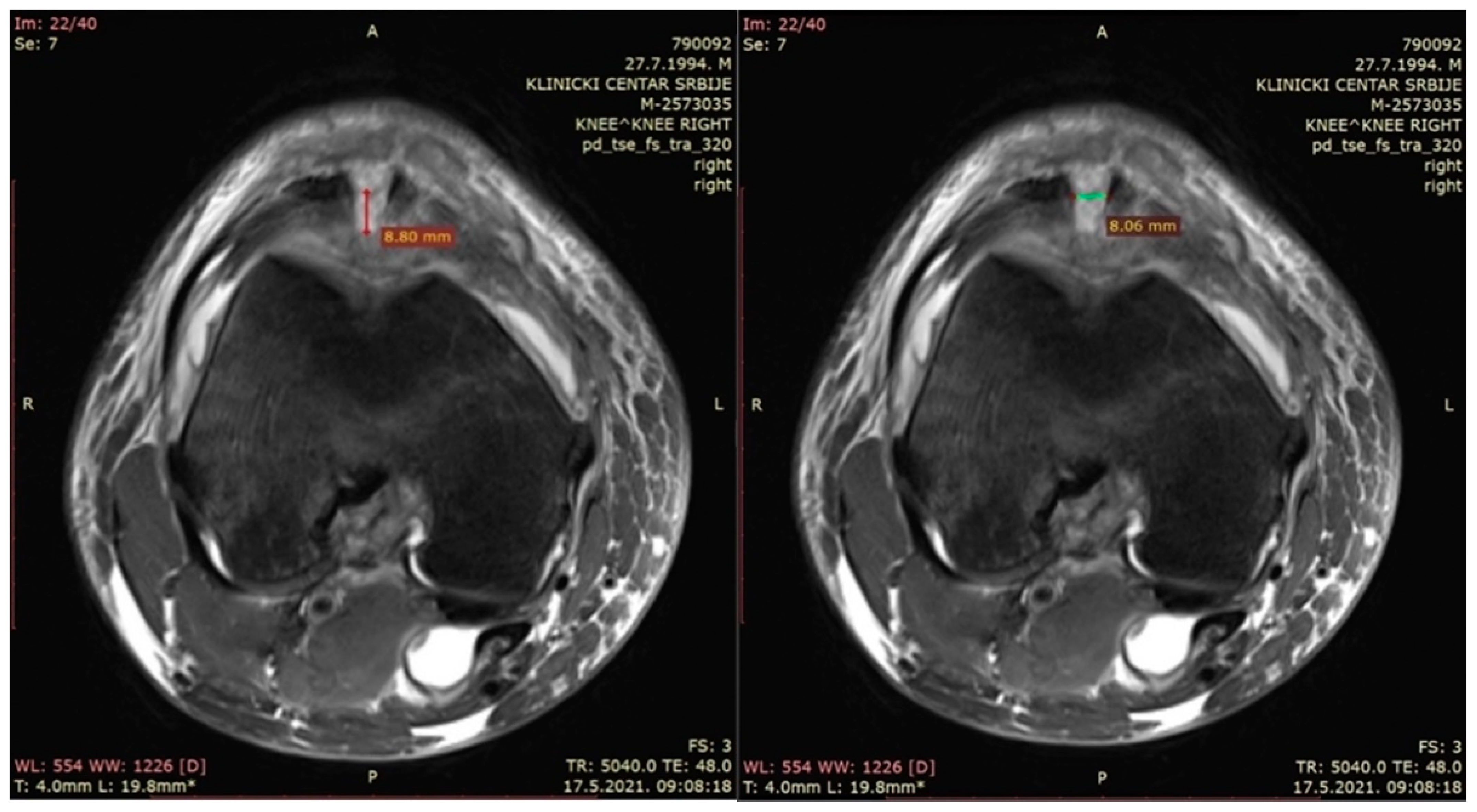 Medicina 60 00154 g003