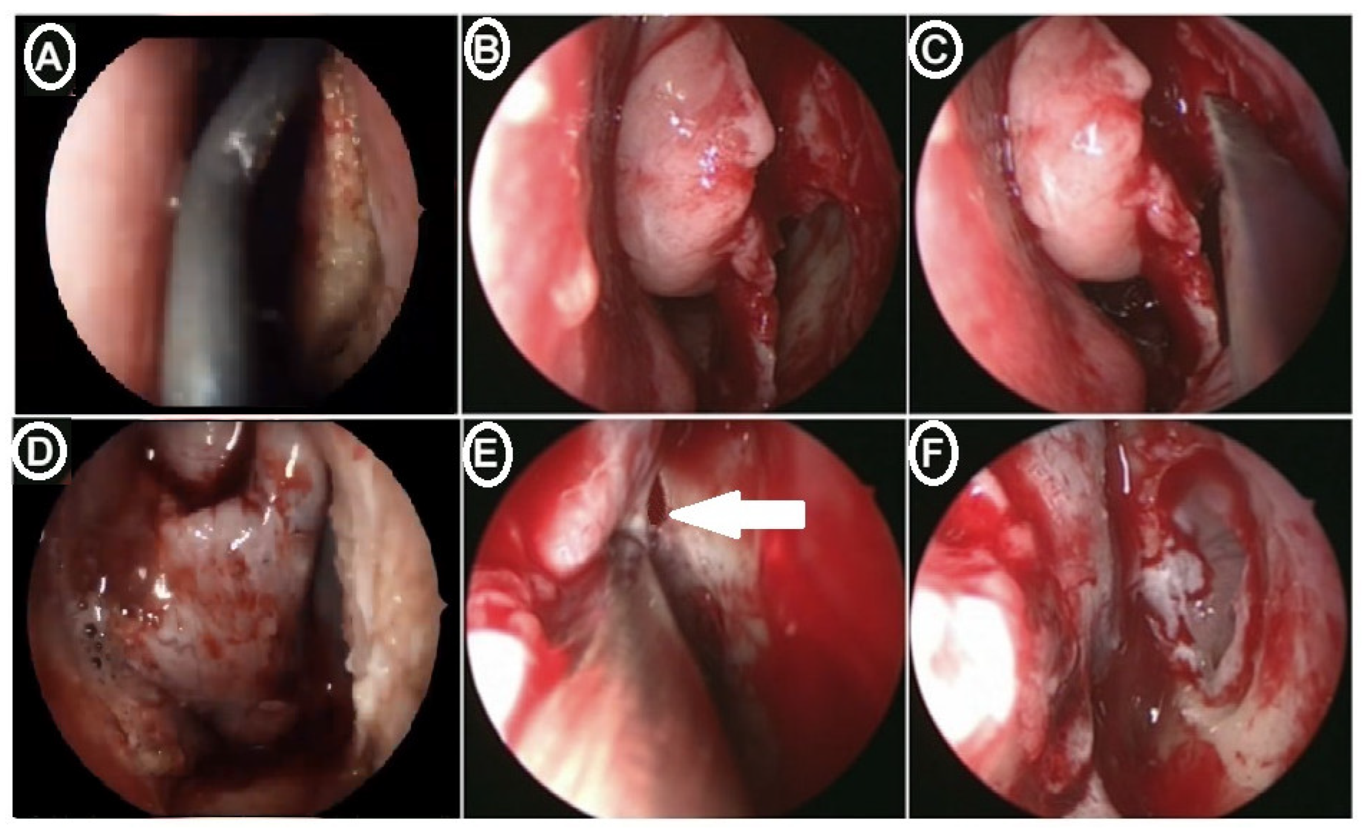 Medicina 60 00222 g004 Medicina 60 00222 g004