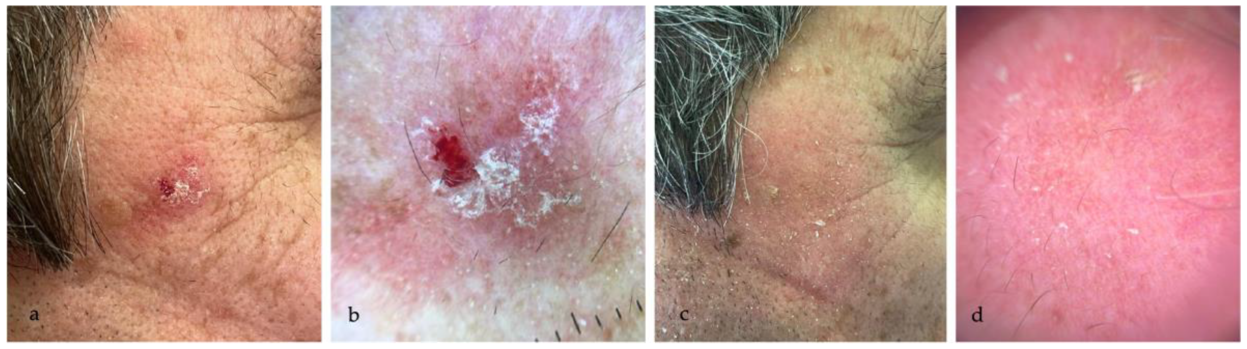 Medicina 60 00225 g001