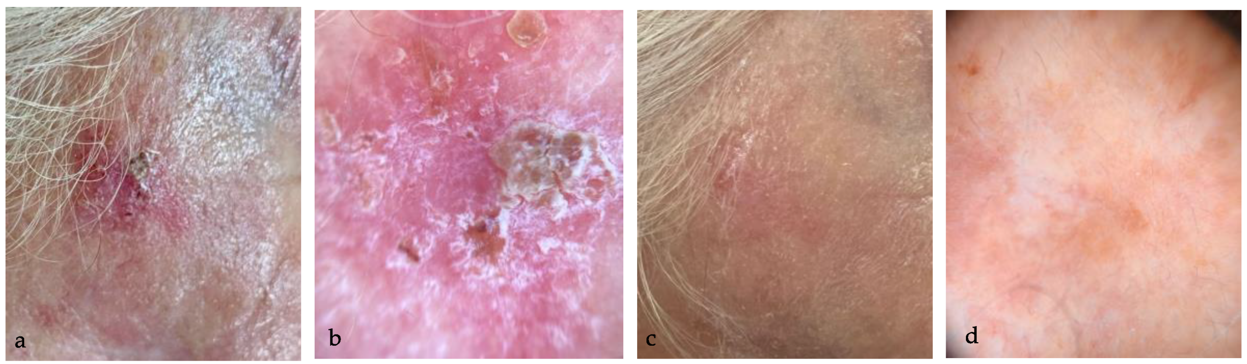 Medicina 60 00225 g002