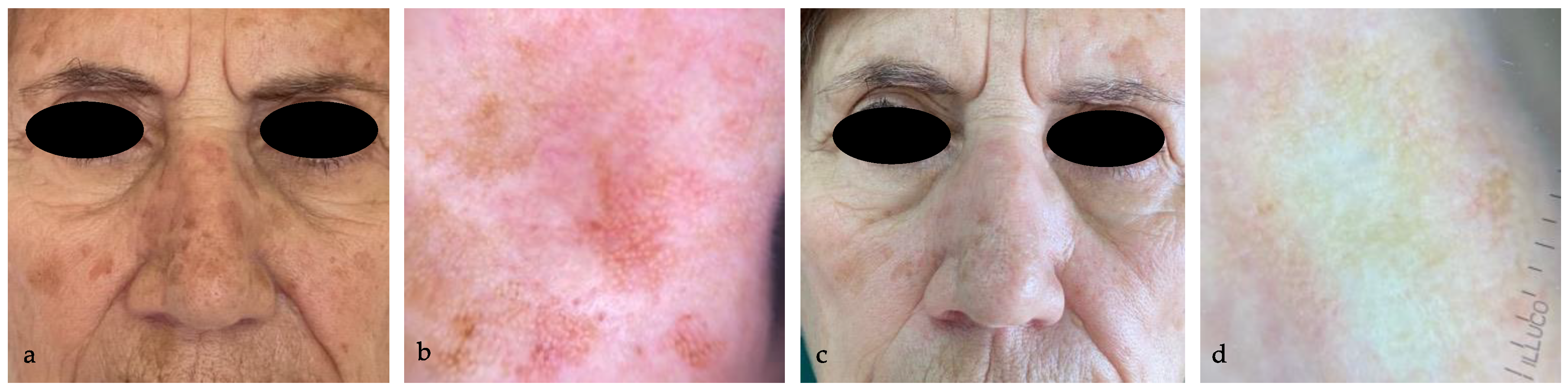 Medicina 60 00225 g003