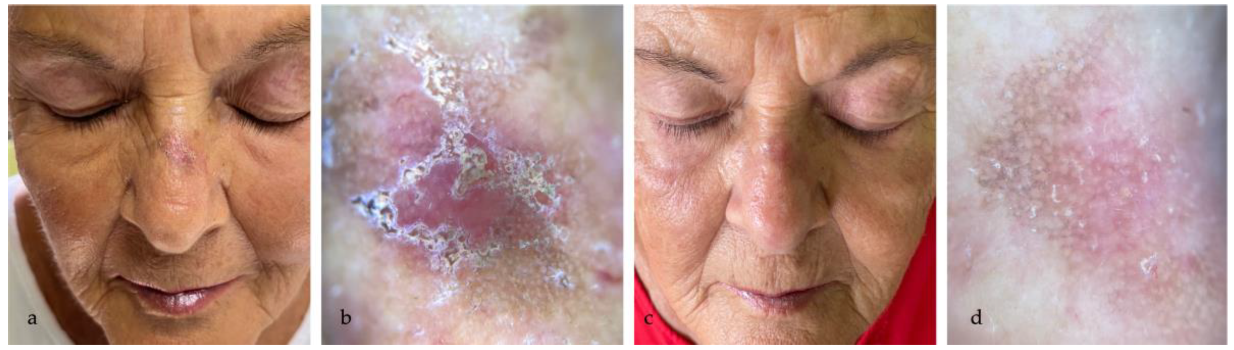 Medicina 60 00225 g004