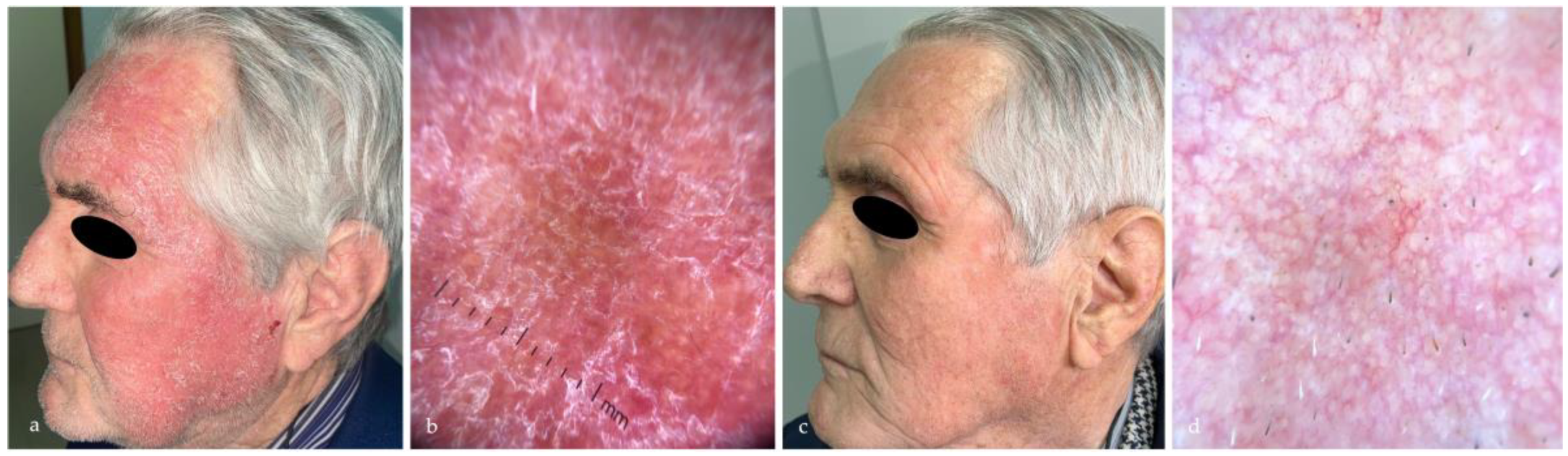 Medicina 60 00225 g005