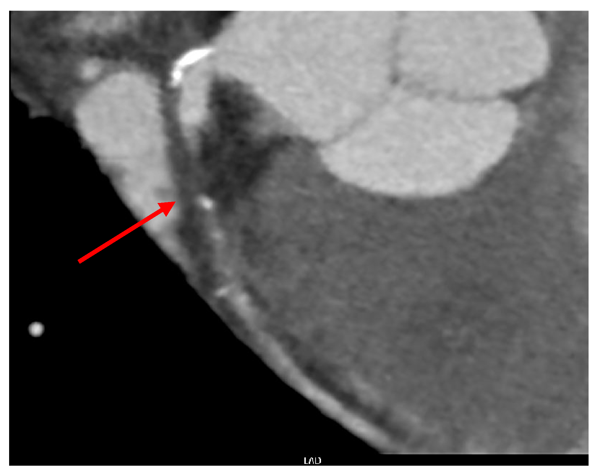 Medicina 60 00232 g003 Medicina 60 00232 g003