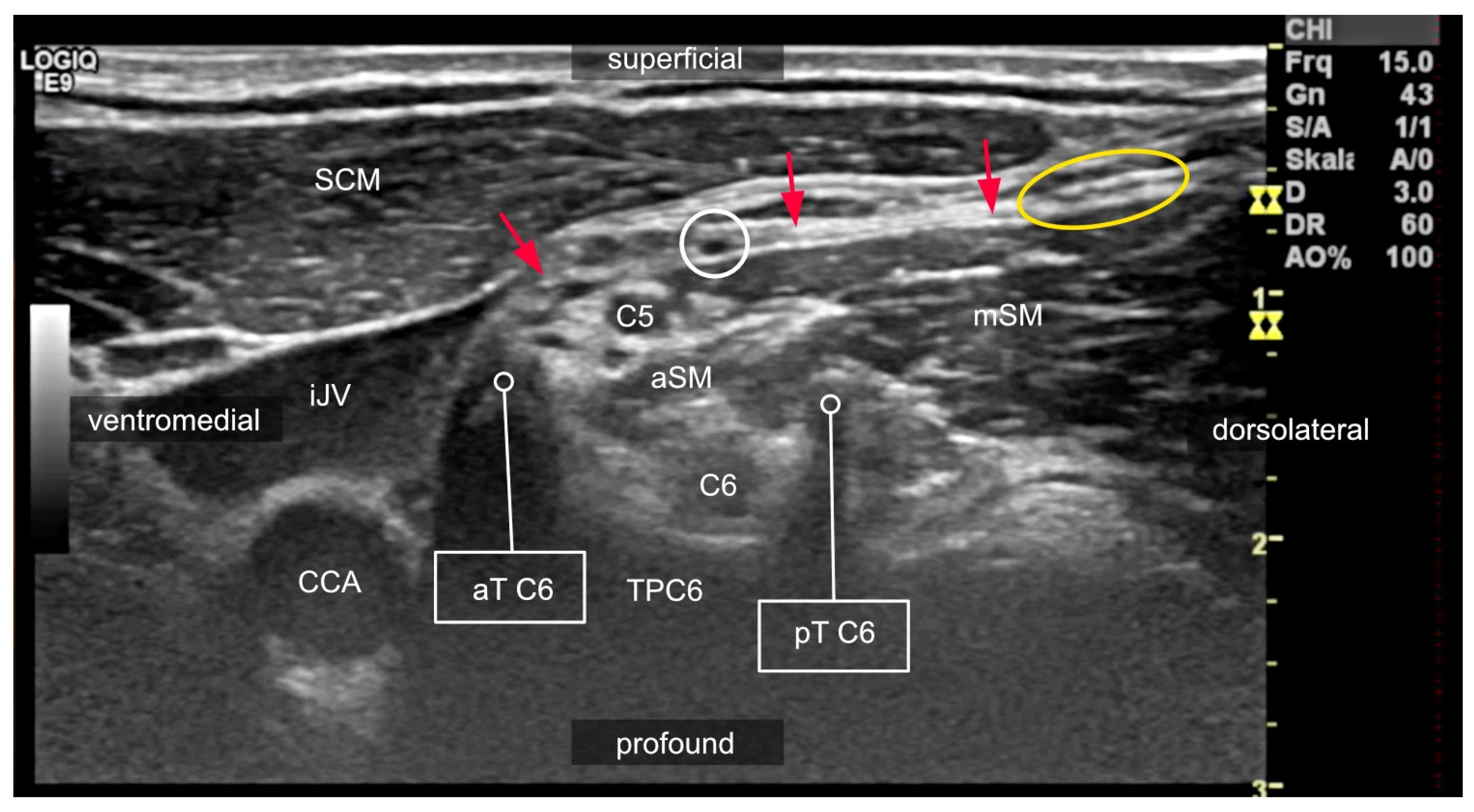 Medicina 60 00233 g004