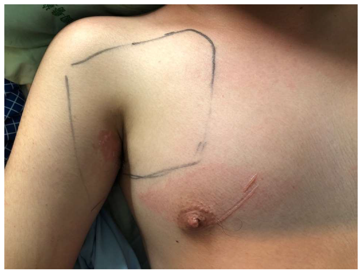 Medicina 60 00300 g004