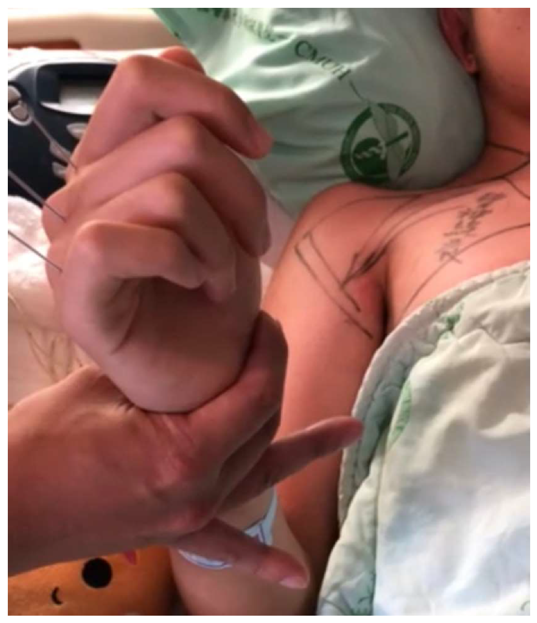 Medicina 60 00300 g005