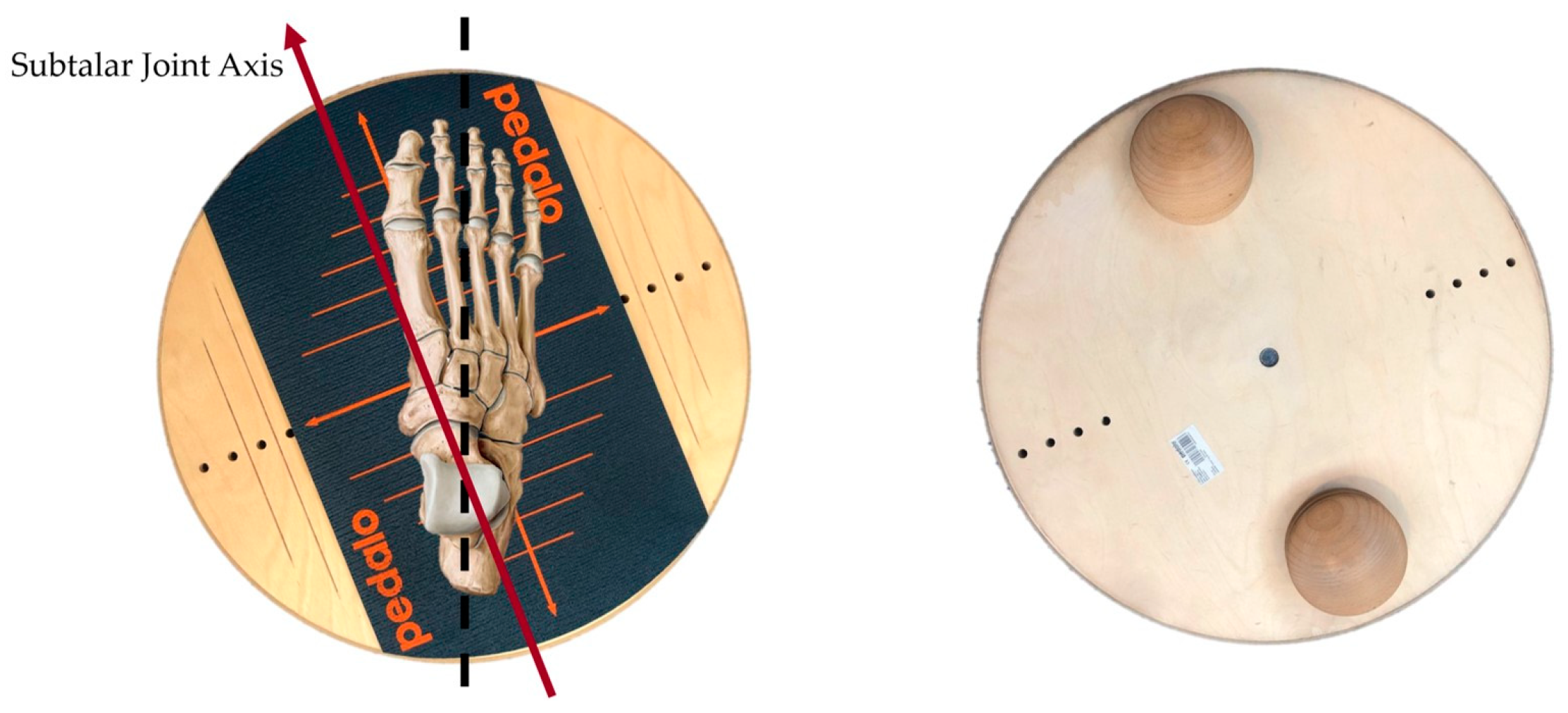 Treating Chronic Ankle Instability