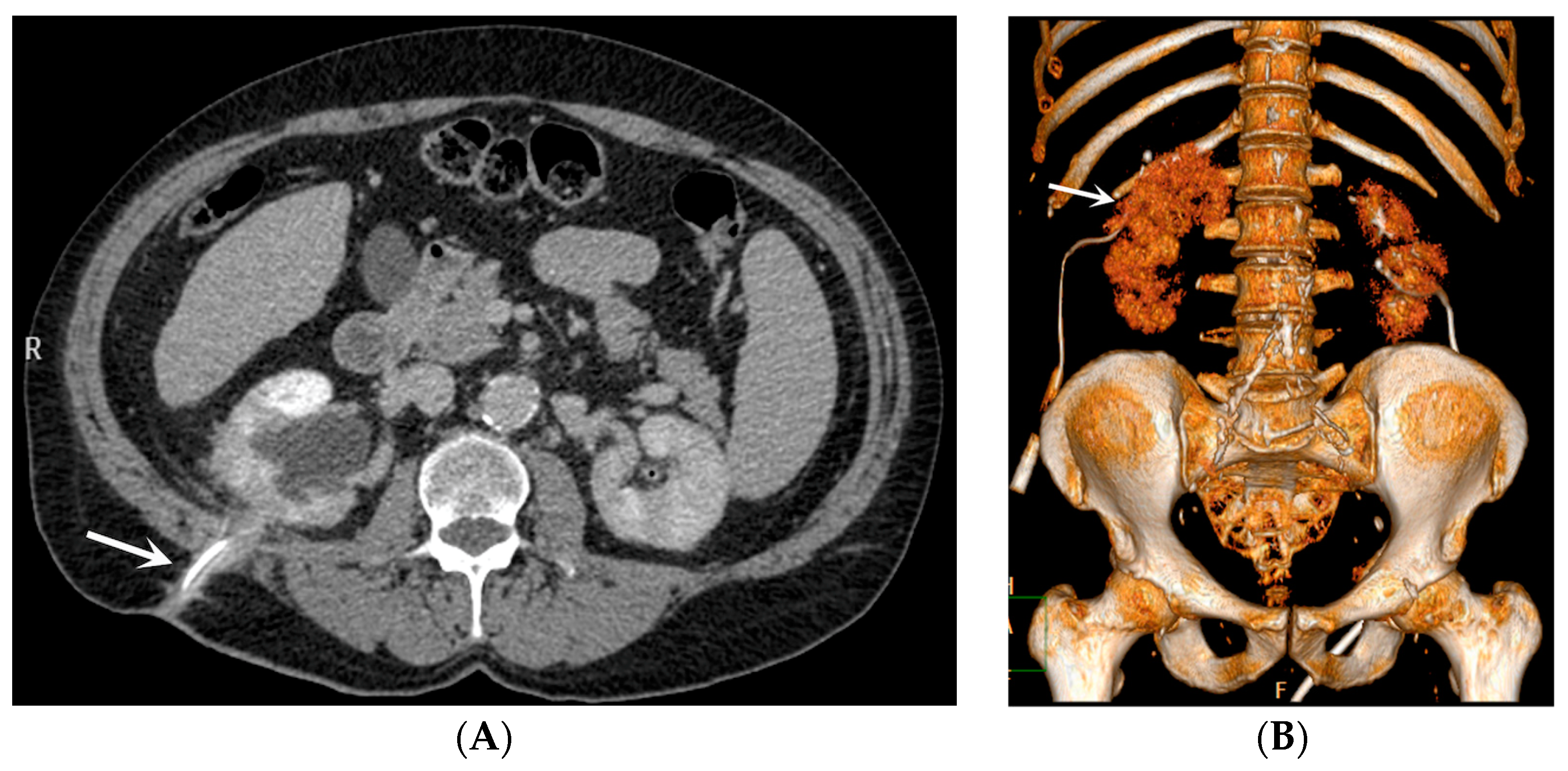 Medicina 60 00338 g002 Medicina 60 00338 g002