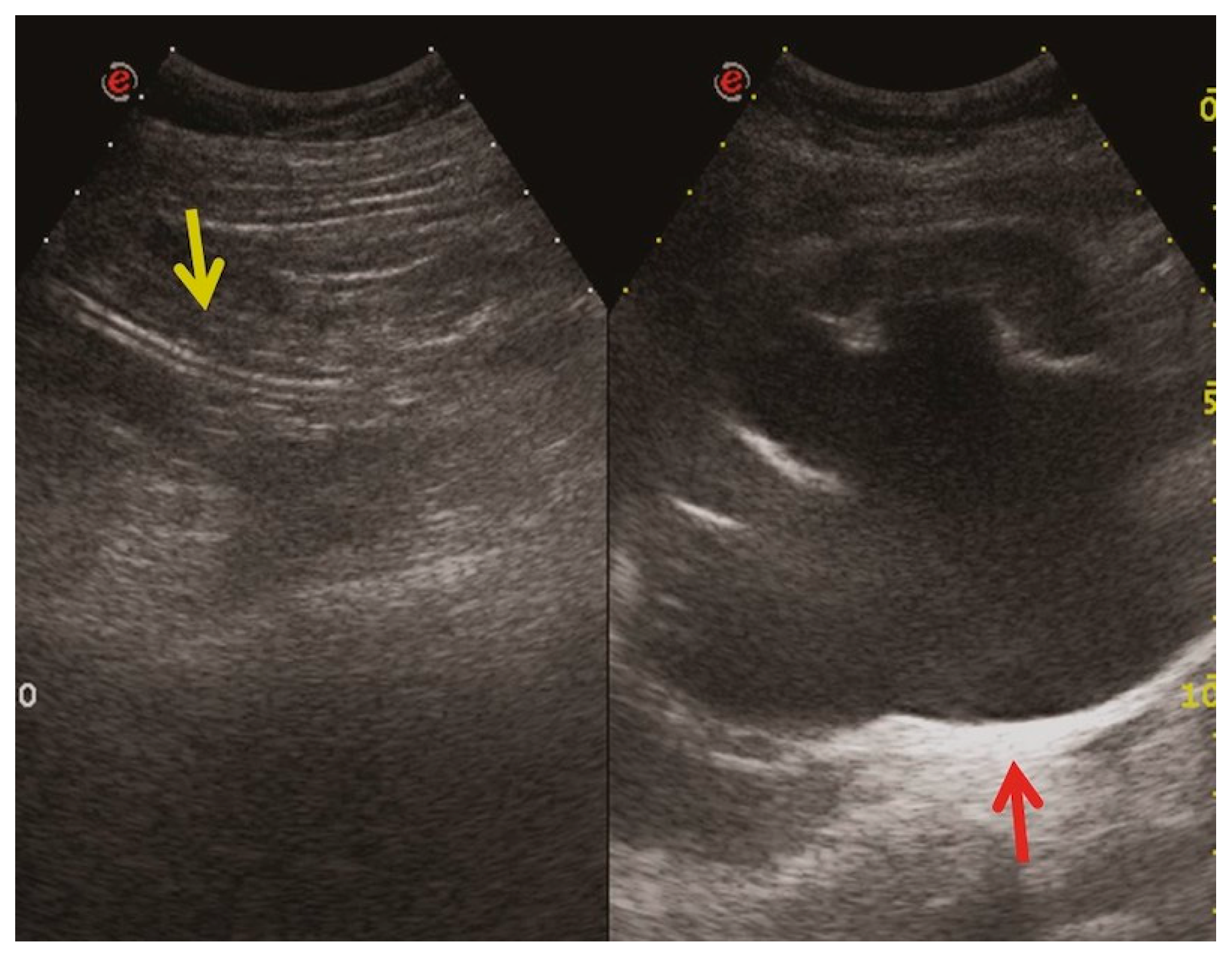 Medicina 60 00338 g003 Medicina 60 00338 g003