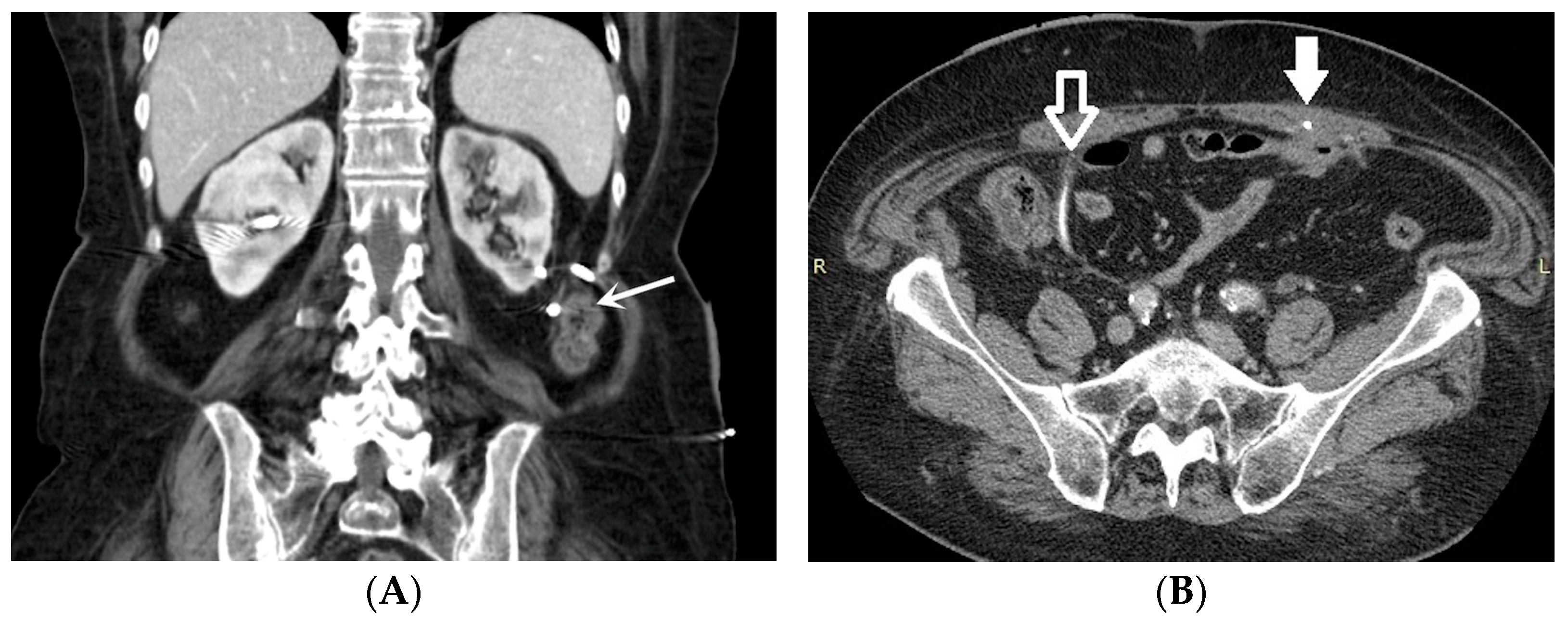 Medicina 60 00338 g004 Medicina 60 00338 g004