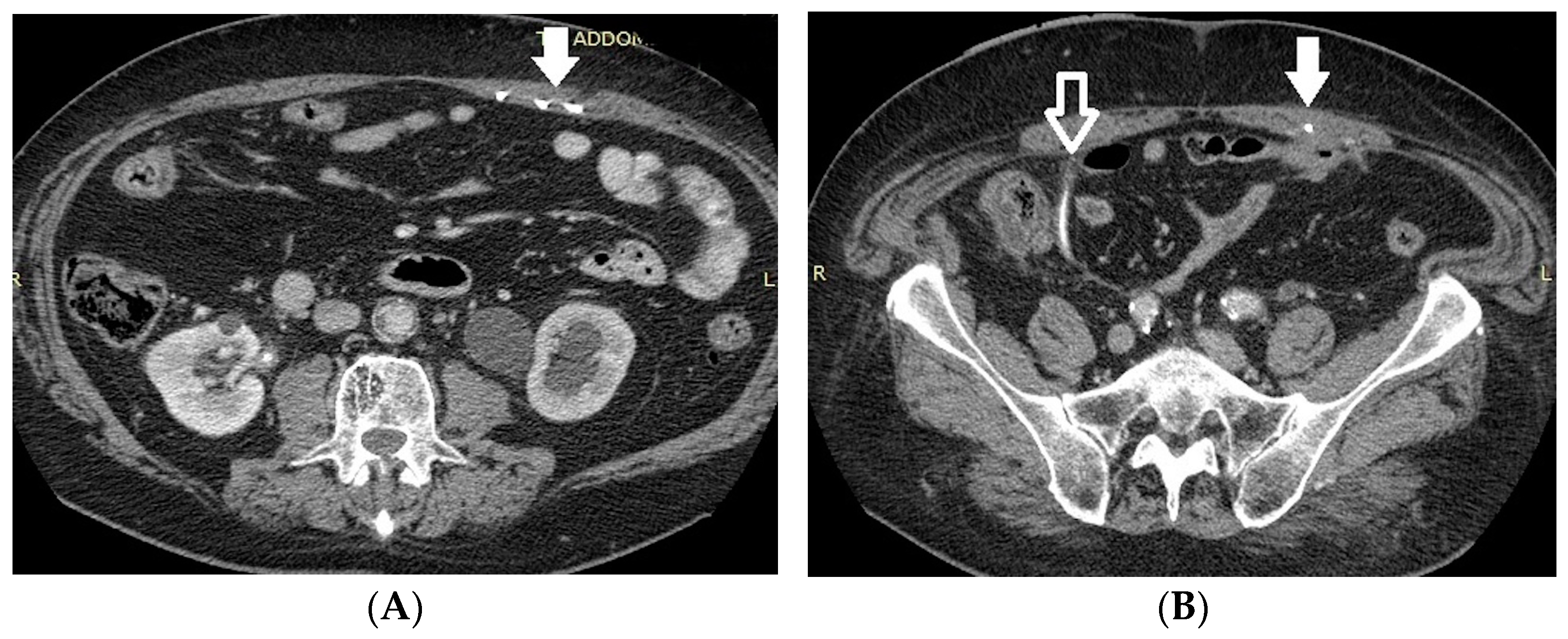 Medicina 60 00338 g005 Medicina 60 00338 g005