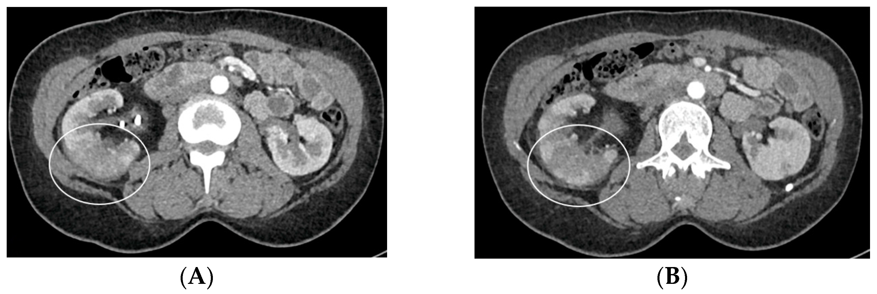 Medicina 60 00338 g008a Medicina 60 00338 g008a