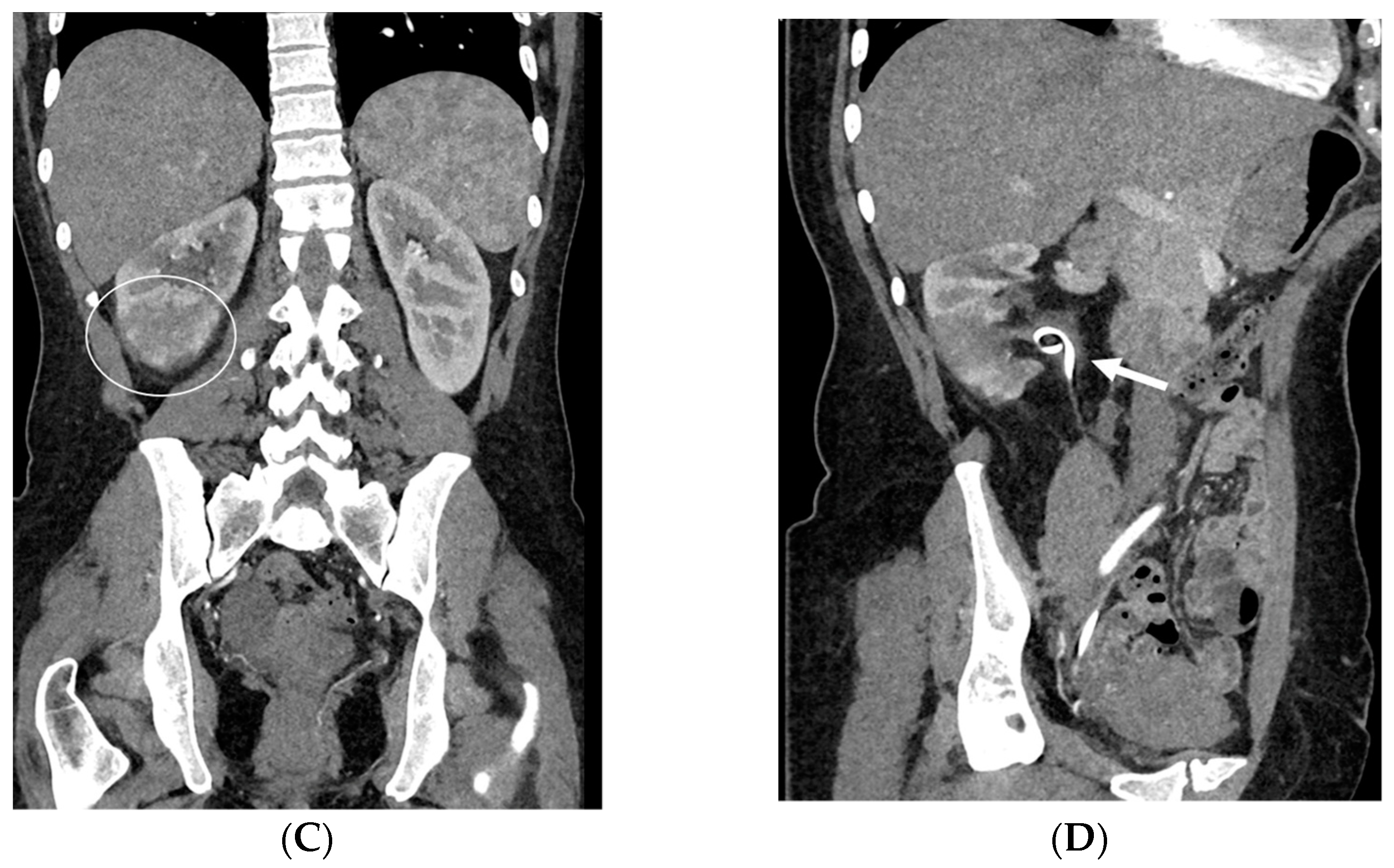 Medicina 60 00338 g008b Medicina 60 00338 g008b