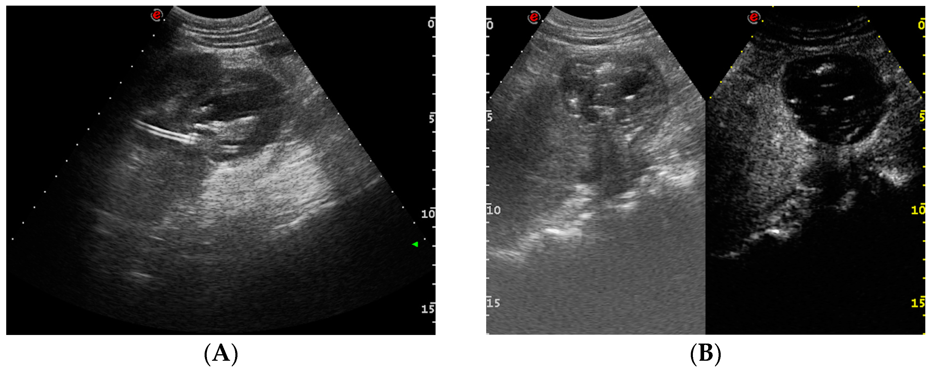 Medicina 60 00338 g011 Medicina 60 00338 g011
