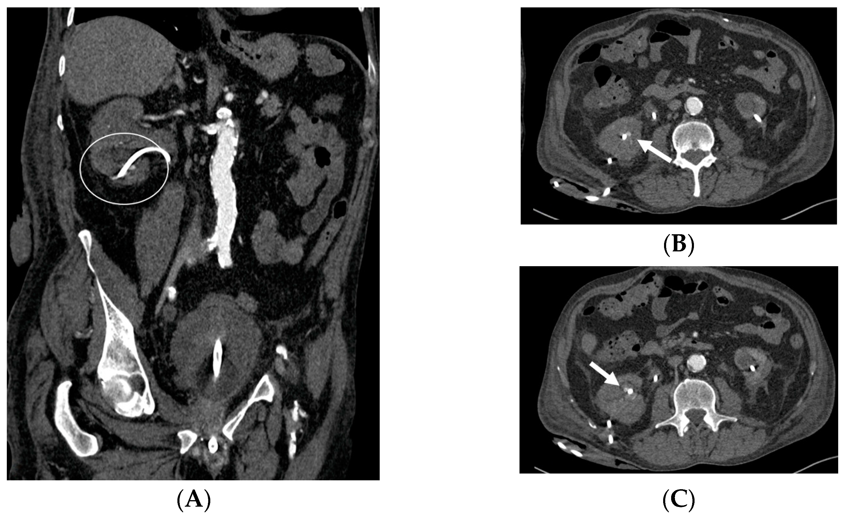 Medicina 60 00338 g013 Medicina 60 00338 g013