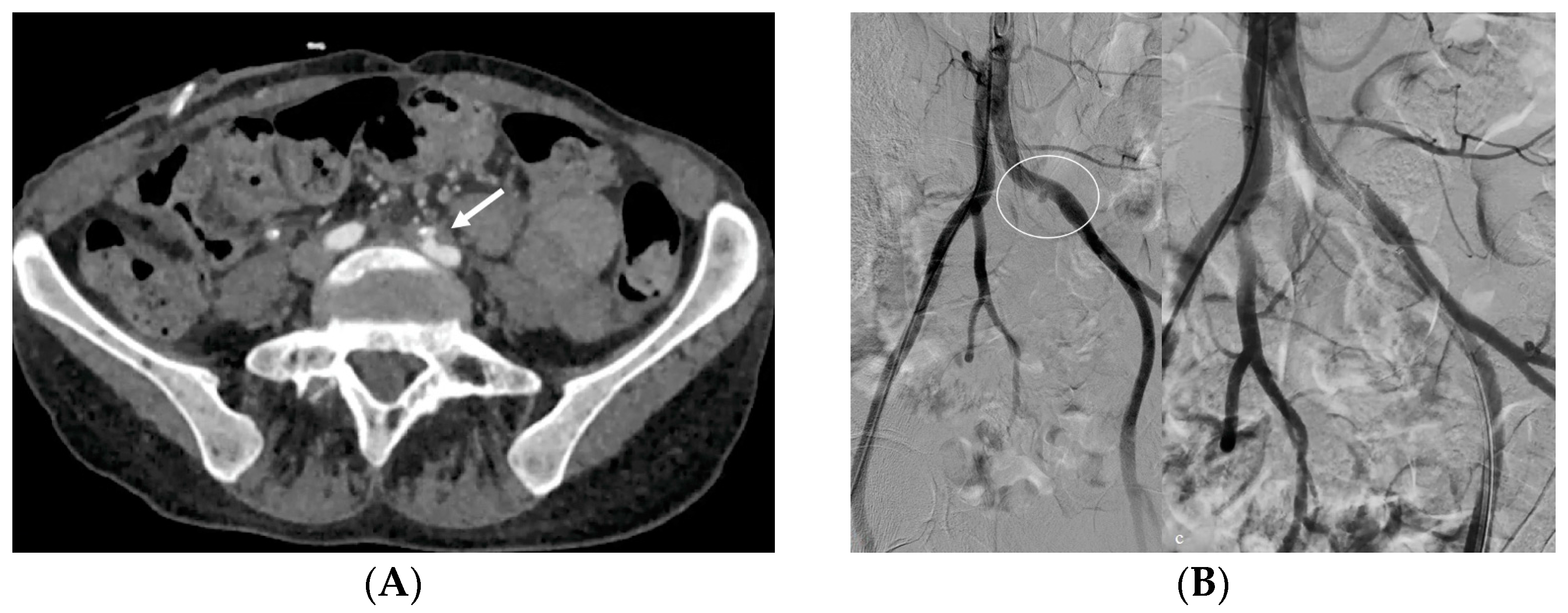 Medicina 60 00338 g014 Medicina 60 00338 g014