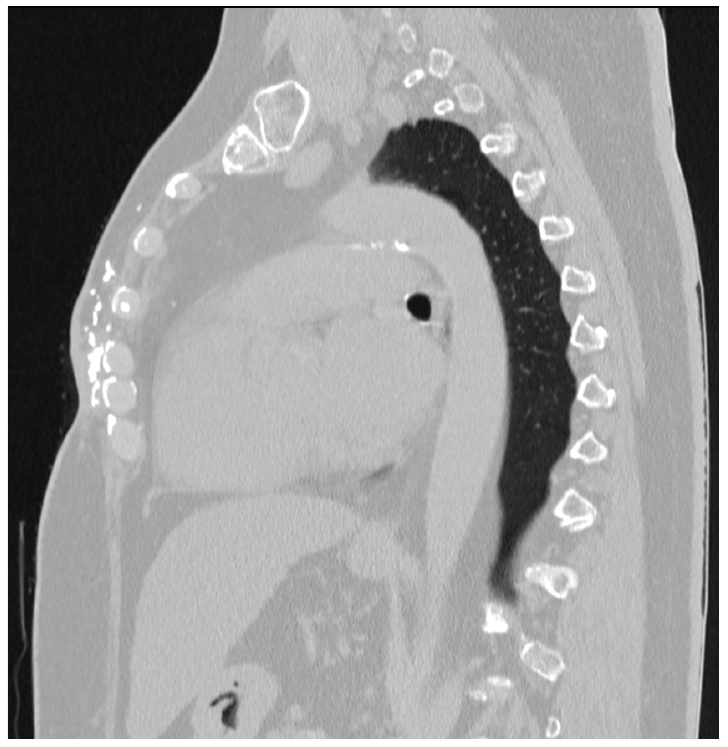 Medicina 60 00399 g002