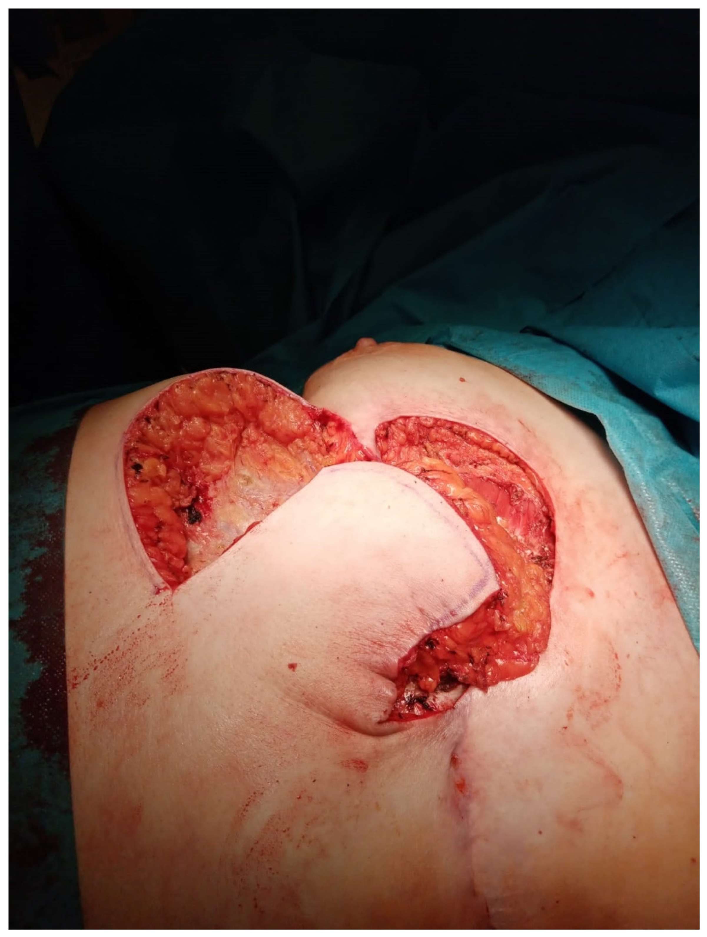 Medicina 60 00399 g004