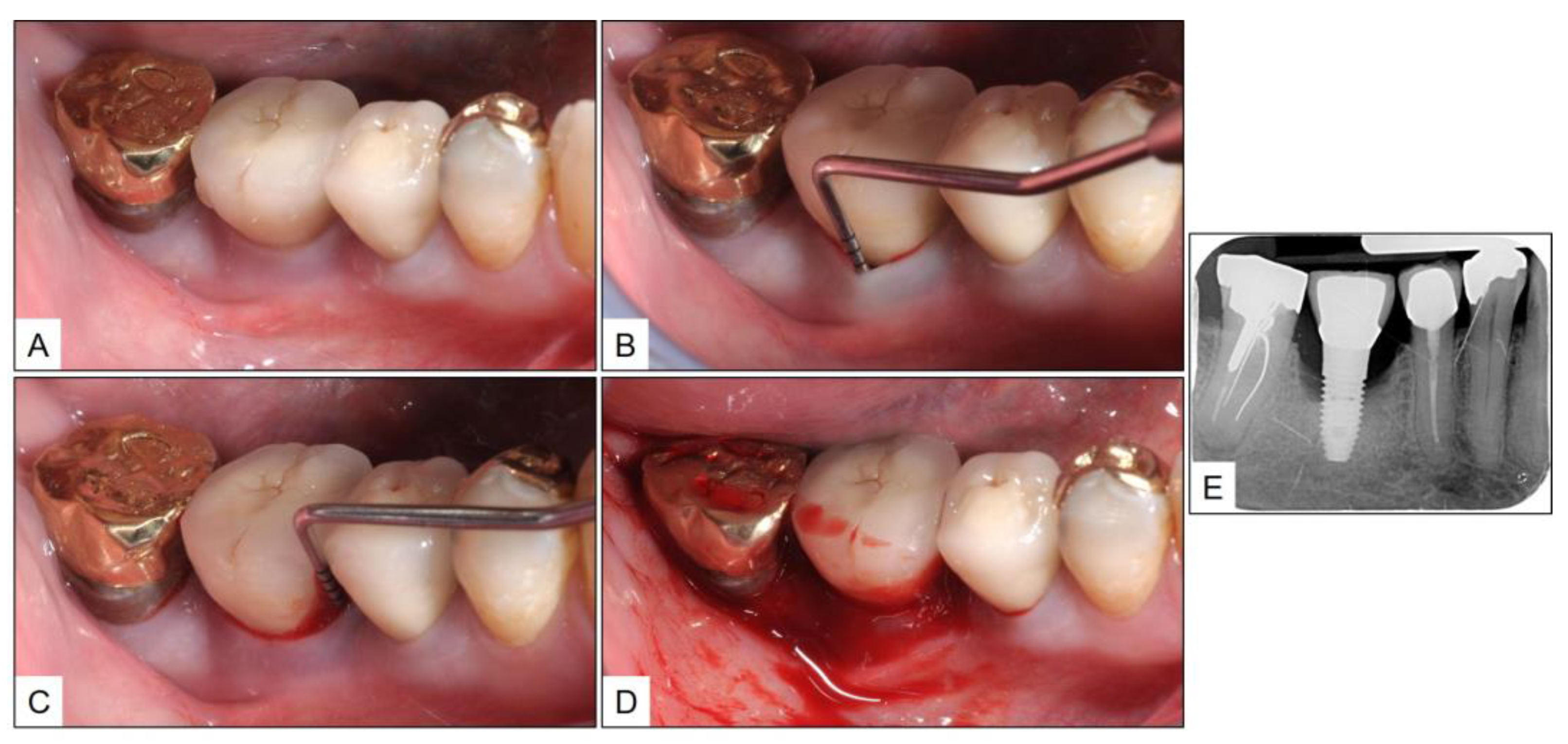 Medicina 60 00447 g004