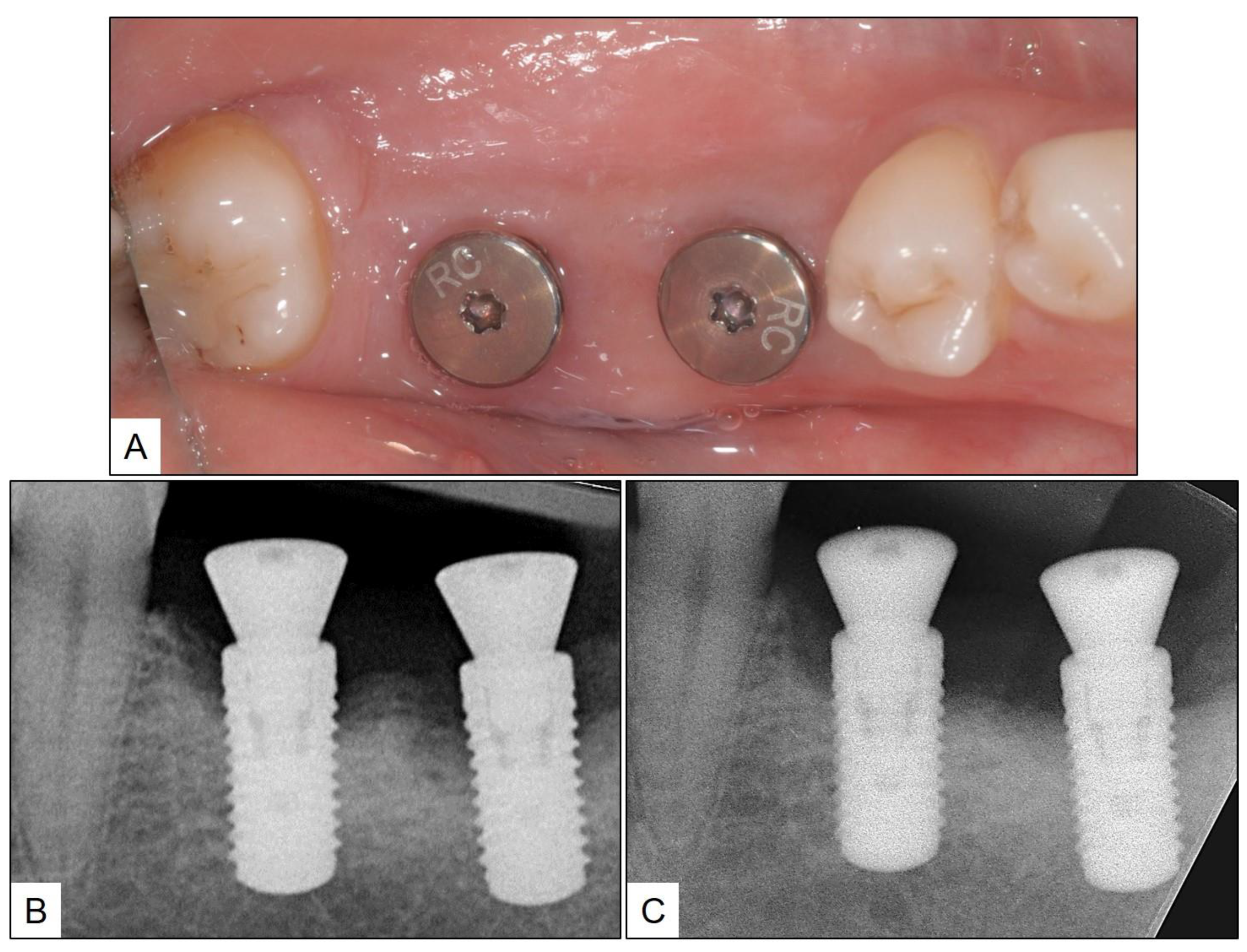 Medicina 60 00447 g010