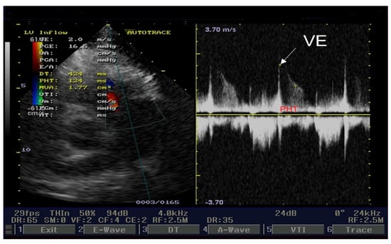 Medicina | Free Full-Text | Takayasu’s Arteritis: A Special Case Report ...