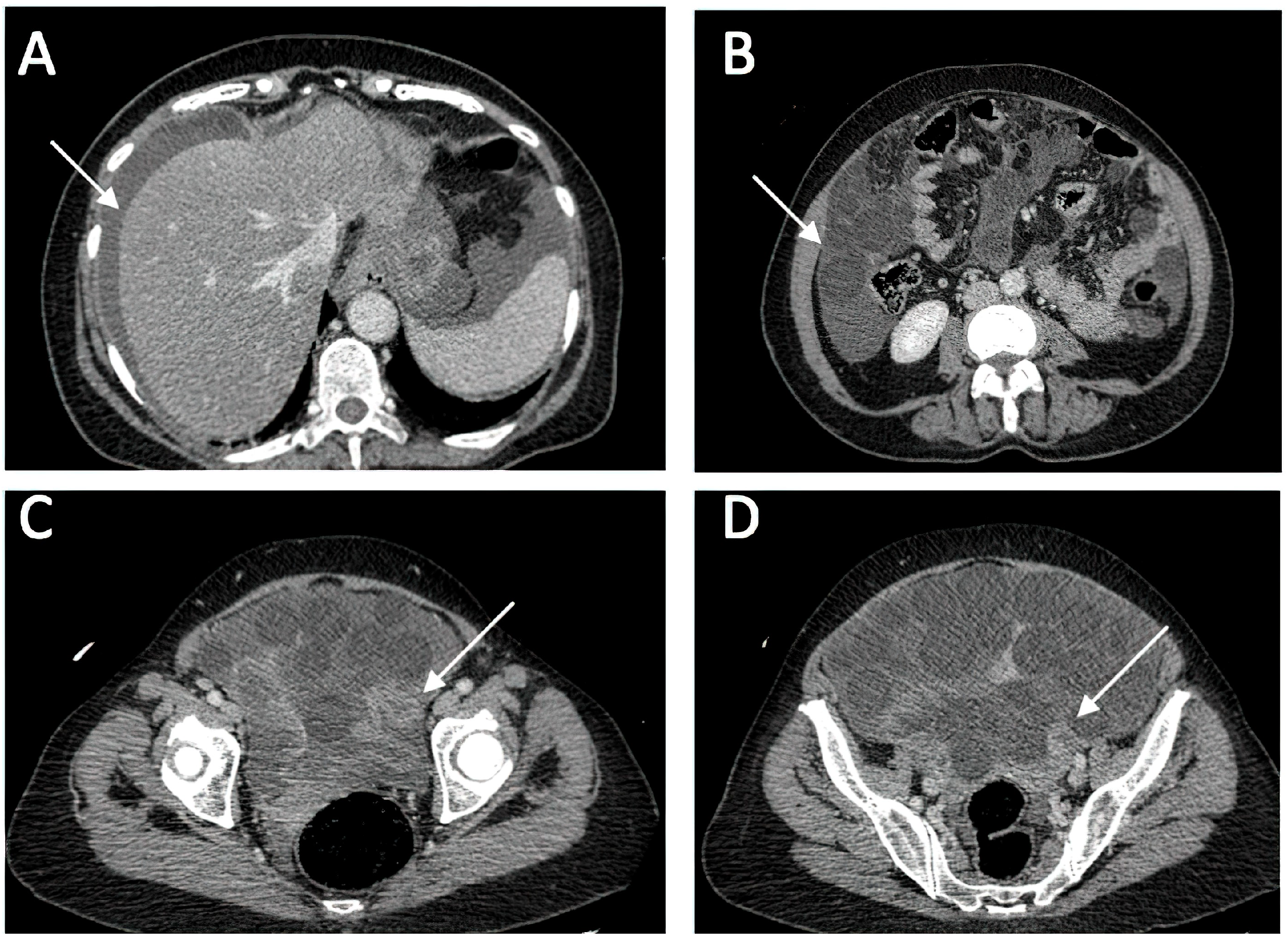 Medicina 60 00460 g001
