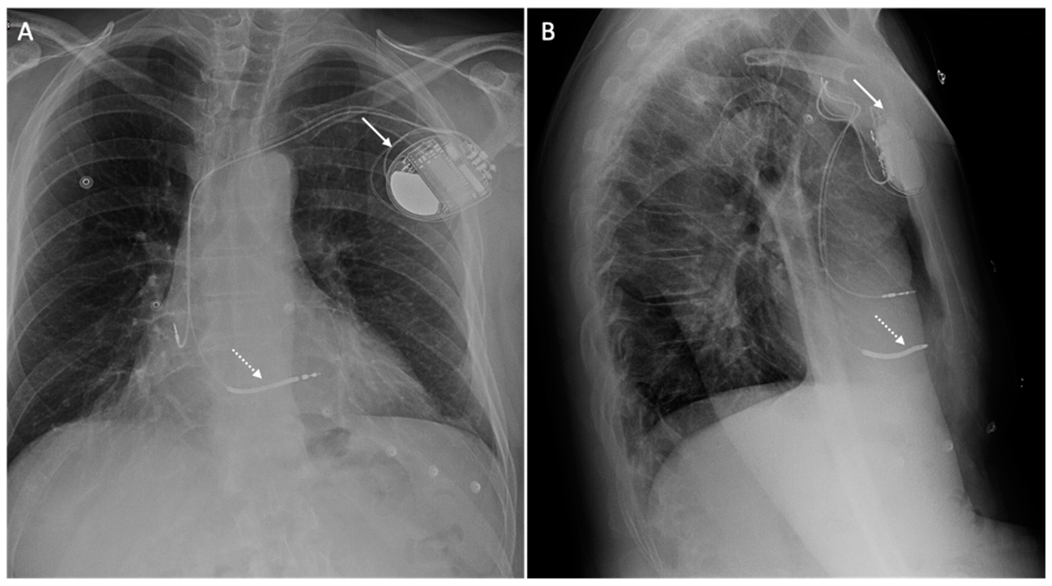 Medicina 60 00522 g002