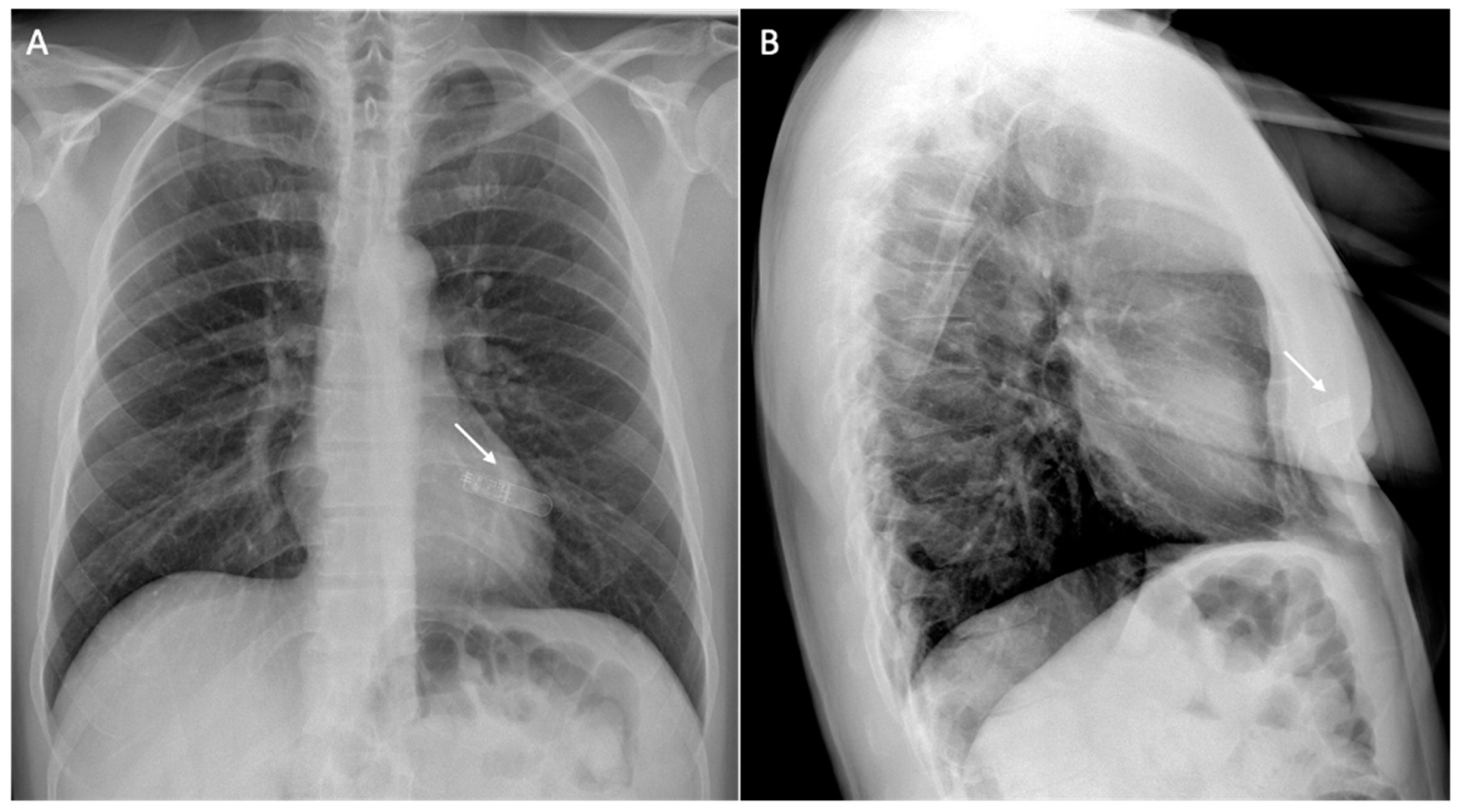 Medicina 60 00522 g004