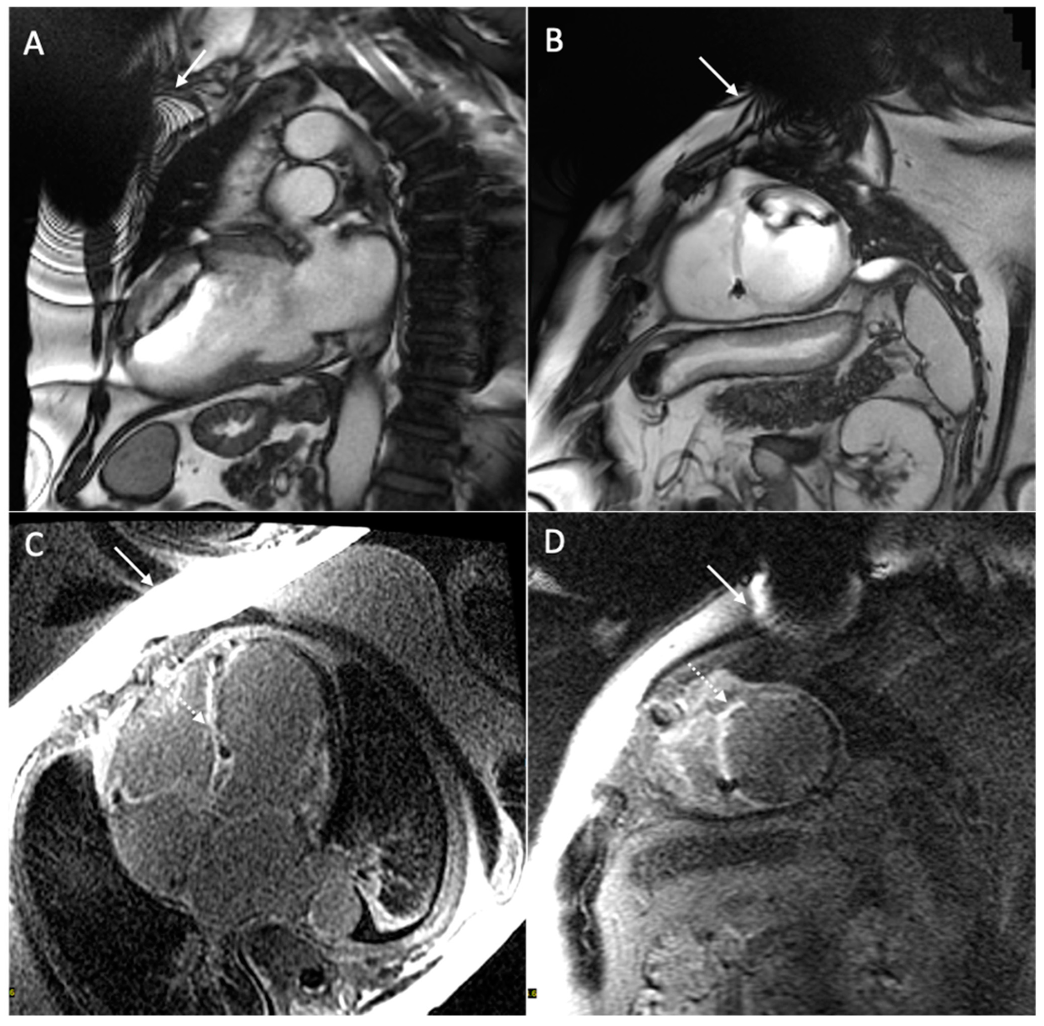 Medicina 60 00522 g005