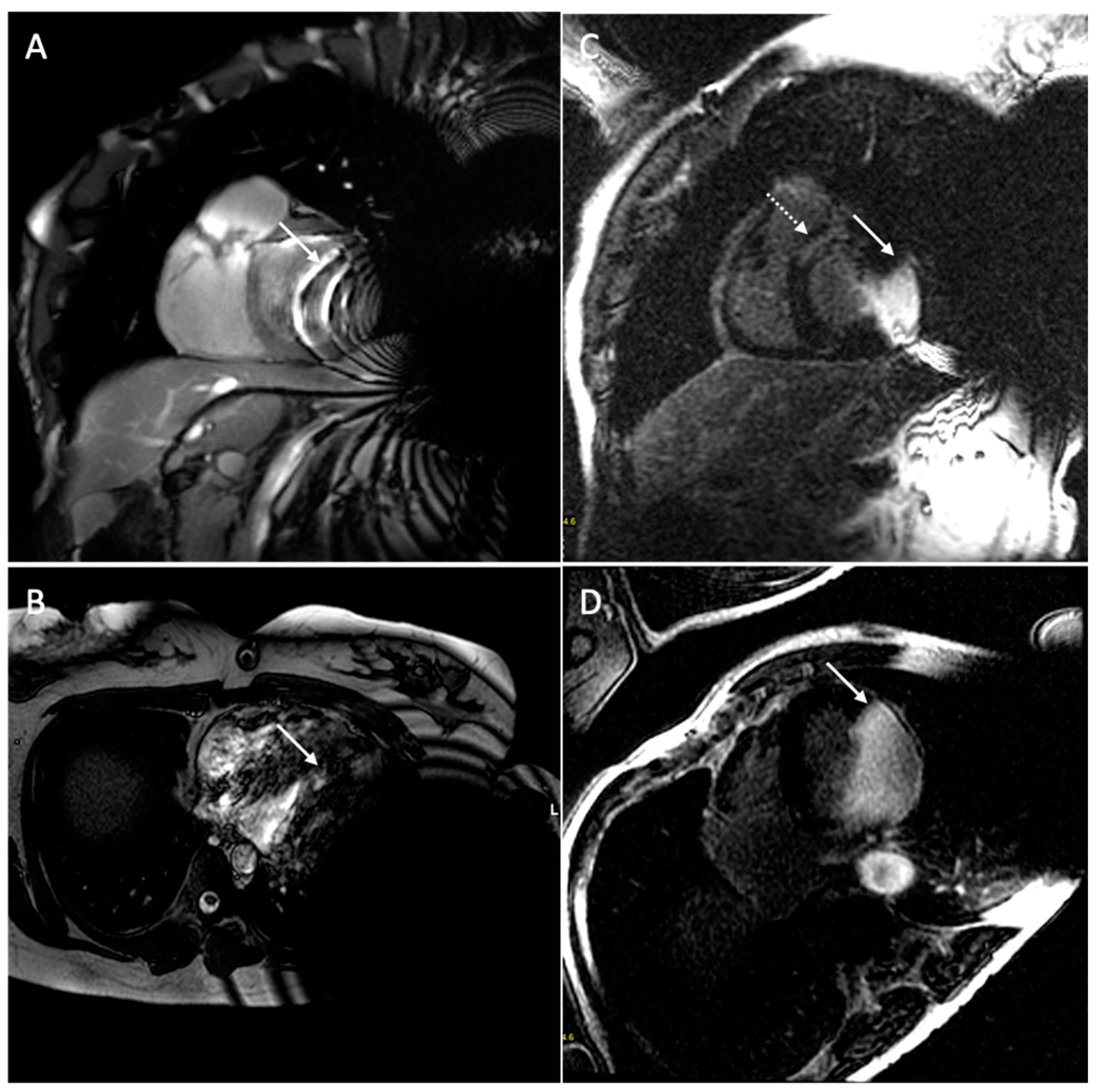 Medicina 60 00522 g009
