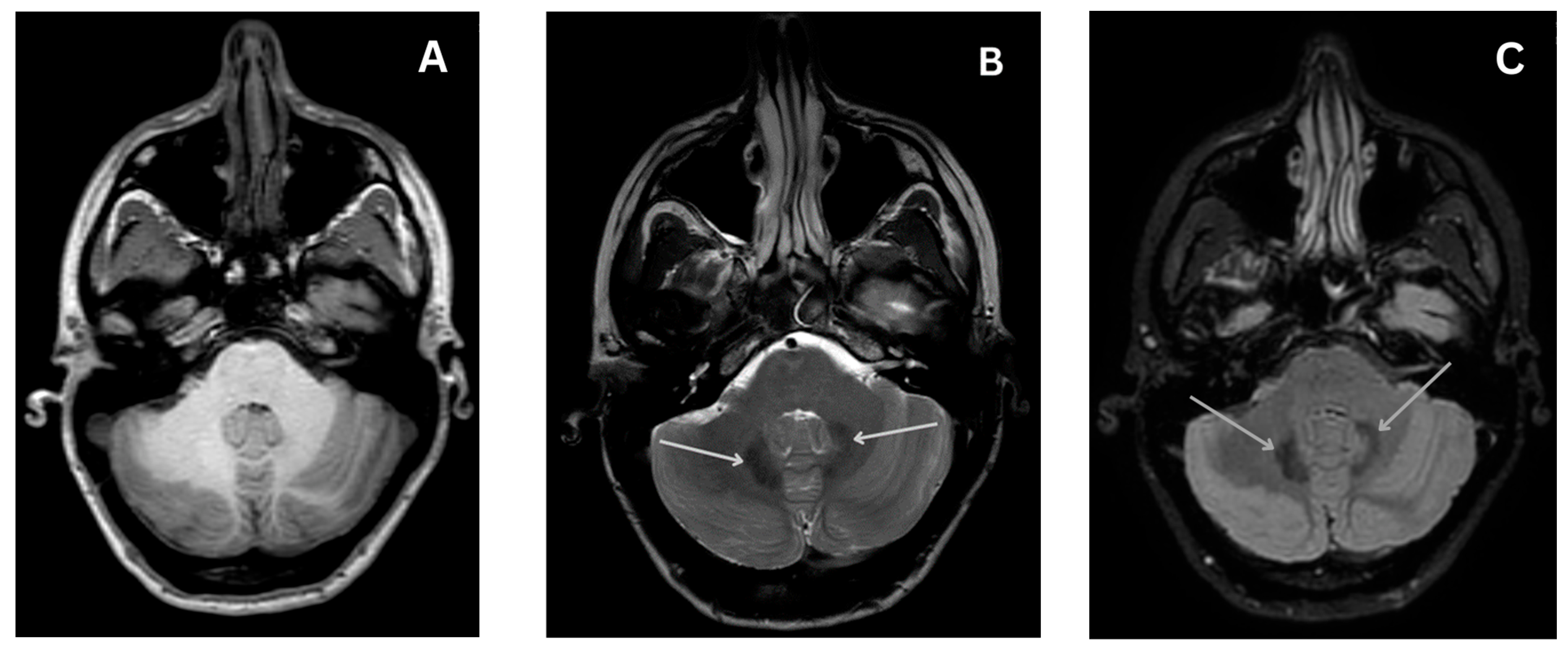 Medicina 60 00589 g002