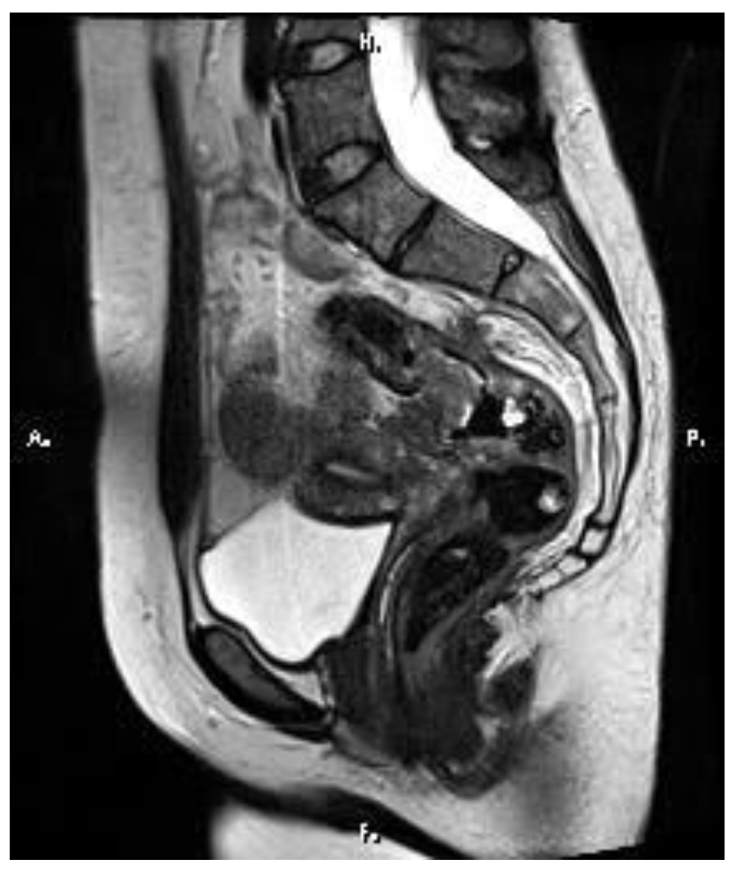 Medicina 60 00696 g002