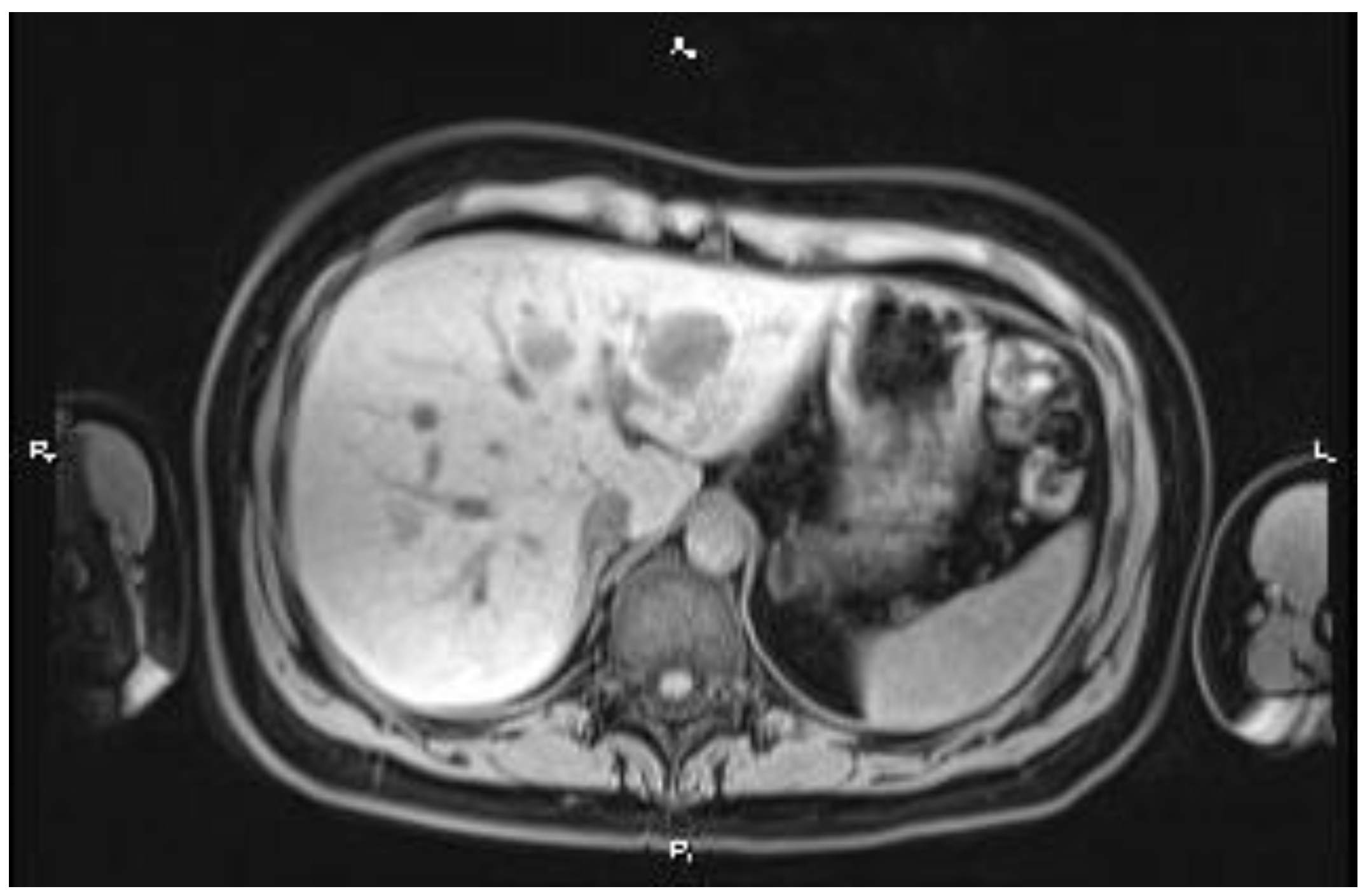 Medicina 60 00696 g003