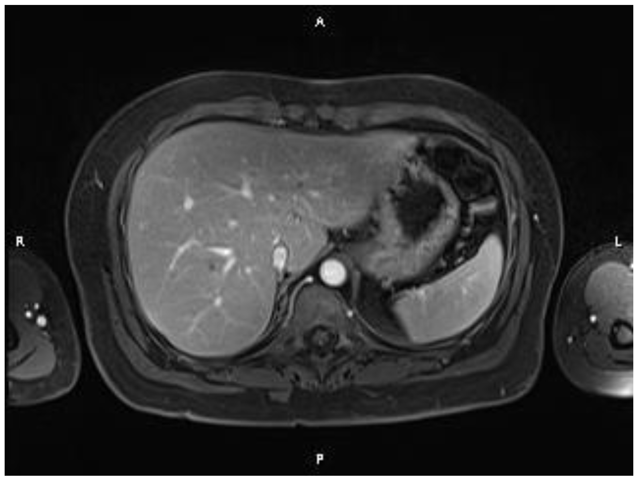 Medicina 60 00696 g004