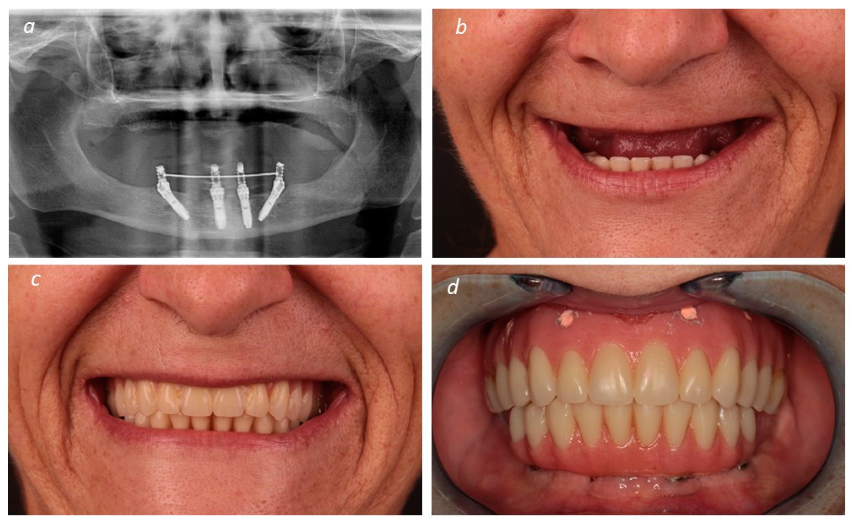 Medicina 60 00720 g001