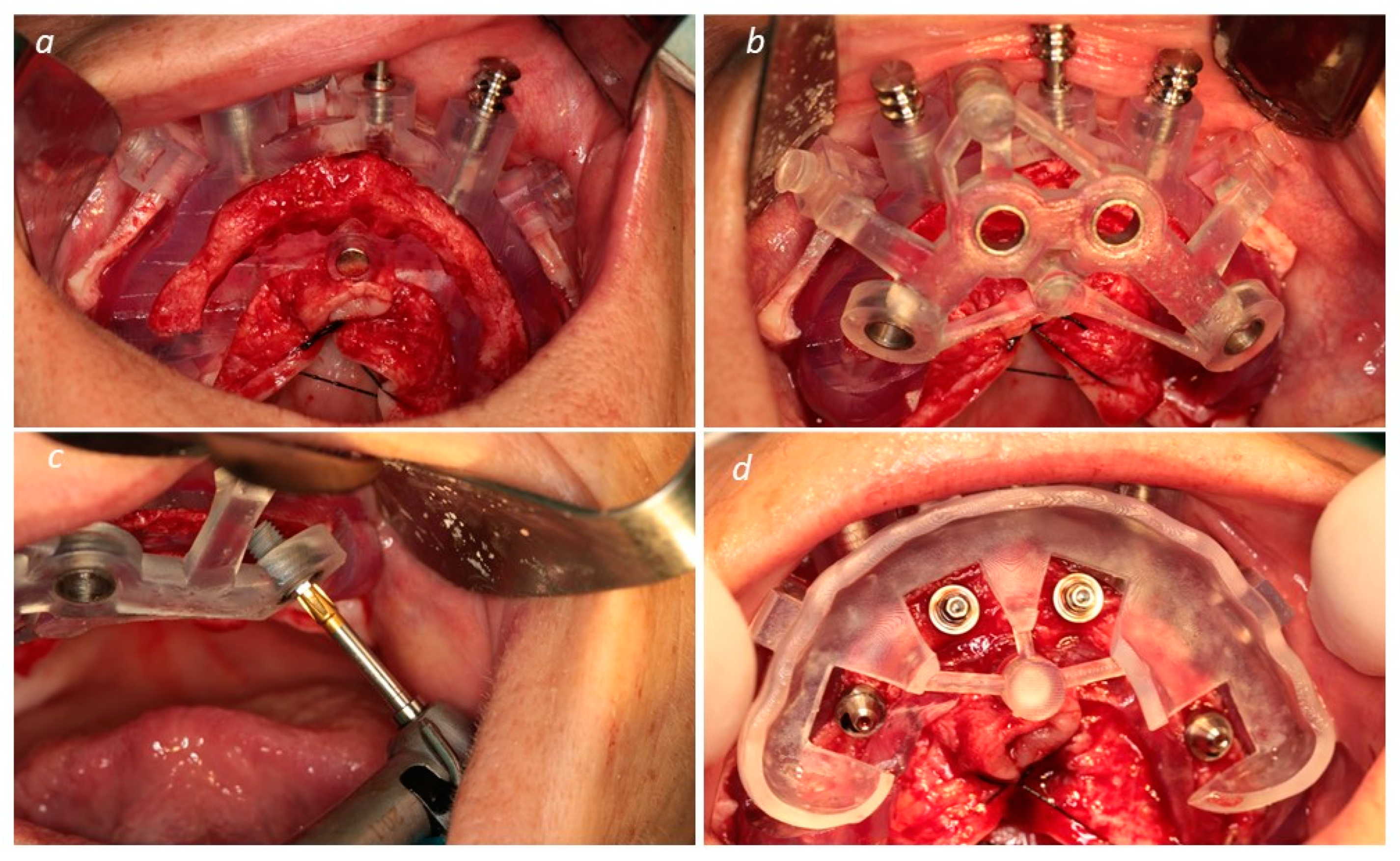 Medicina 60 00720 g003a