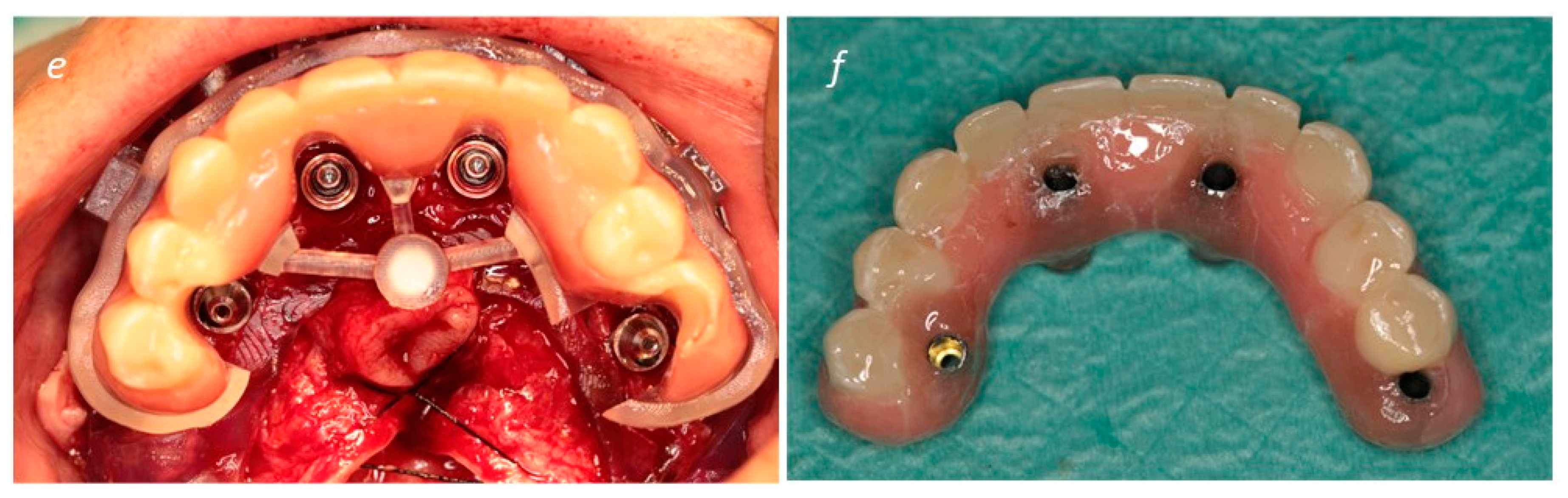 Medicina 60 00720 g003b