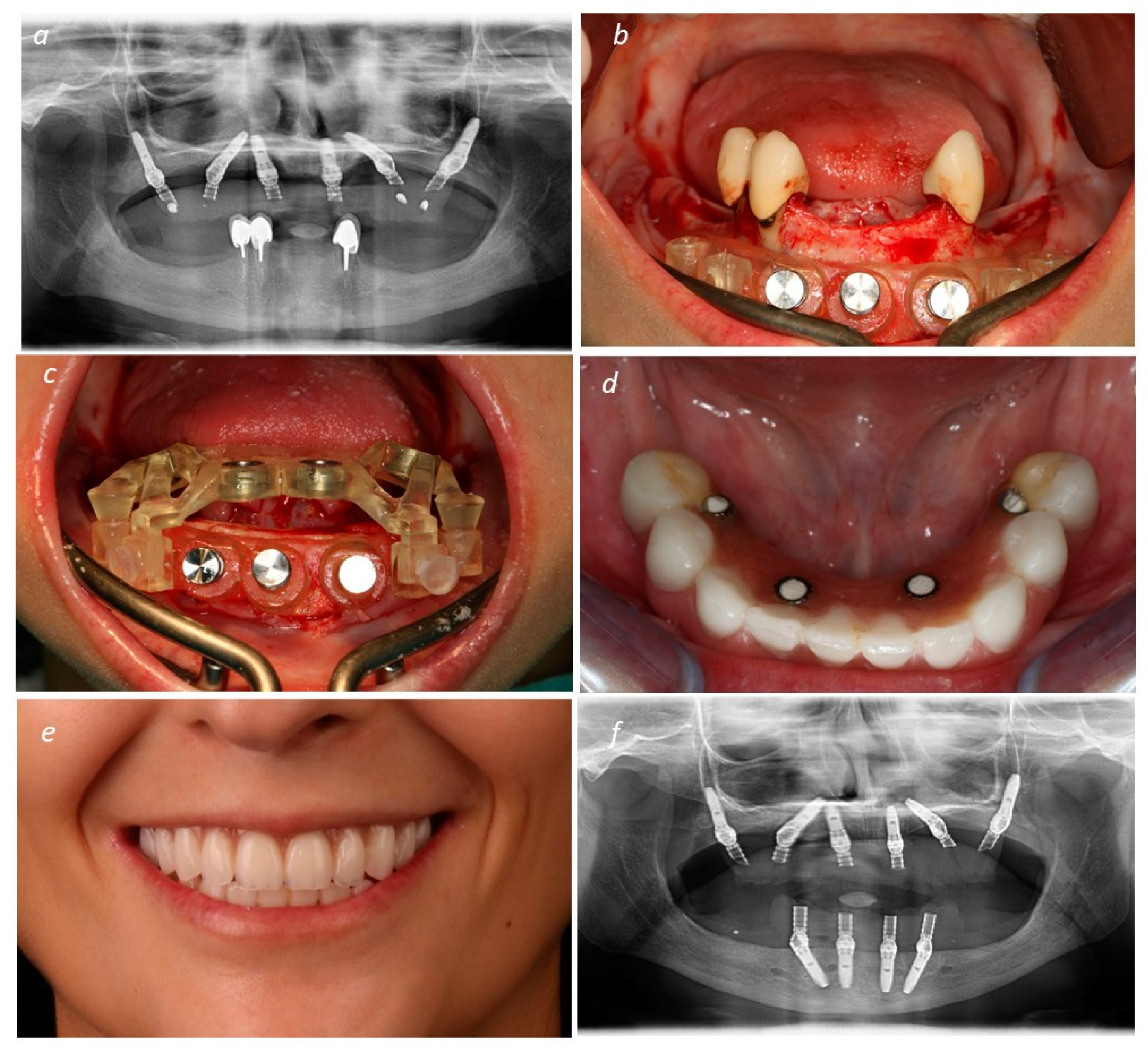 Medicina 60 00720 g006
