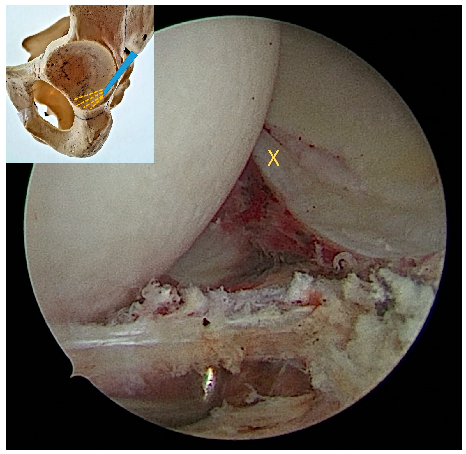 Medicina 60 00738 g003