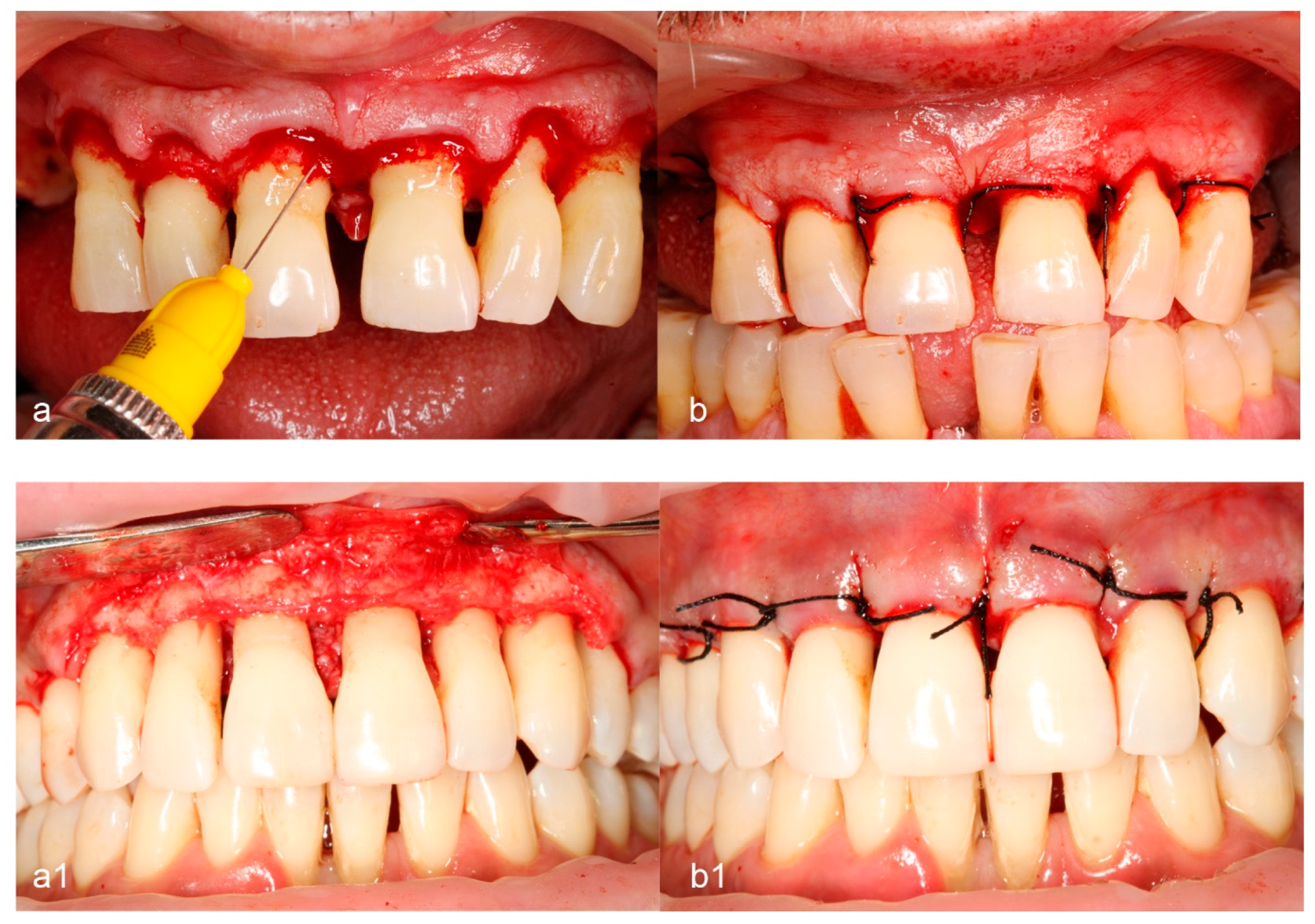 Medicina 60 00829 g002