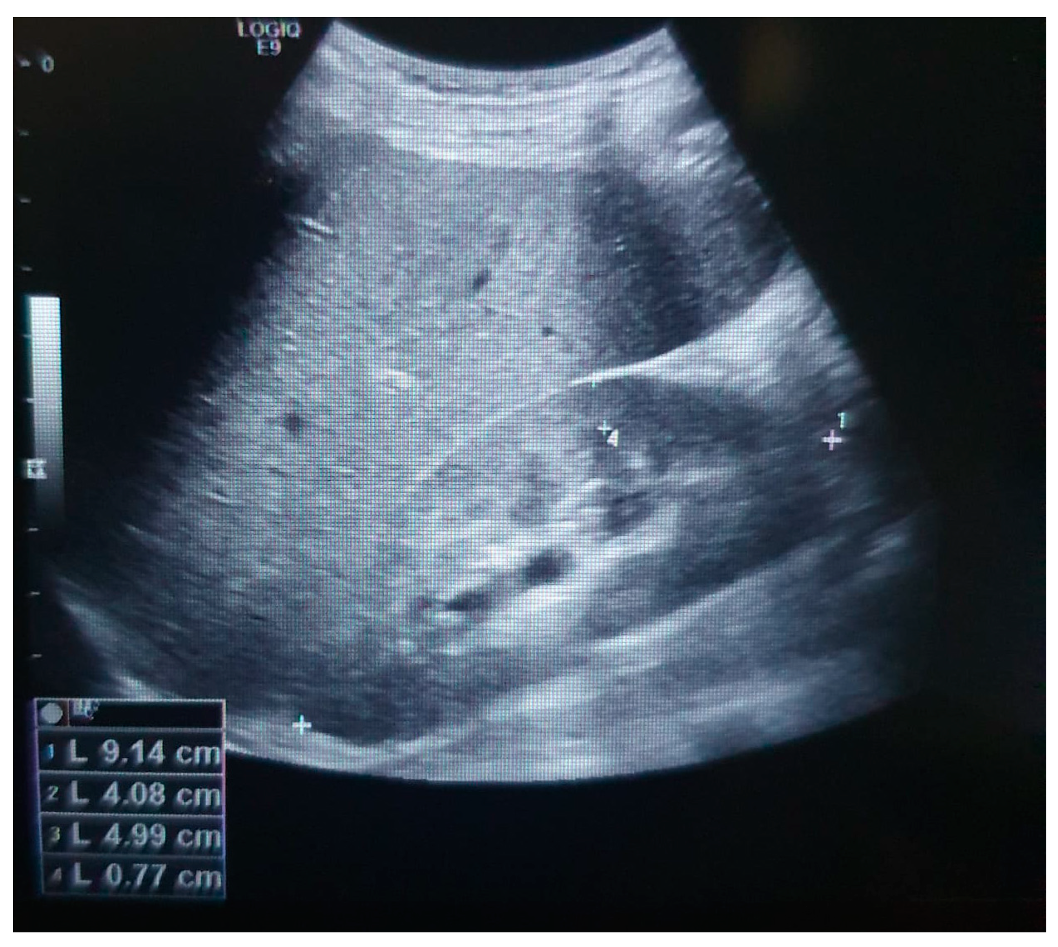 Medicina 60 00830 g002 Medicina 60 00830 g002