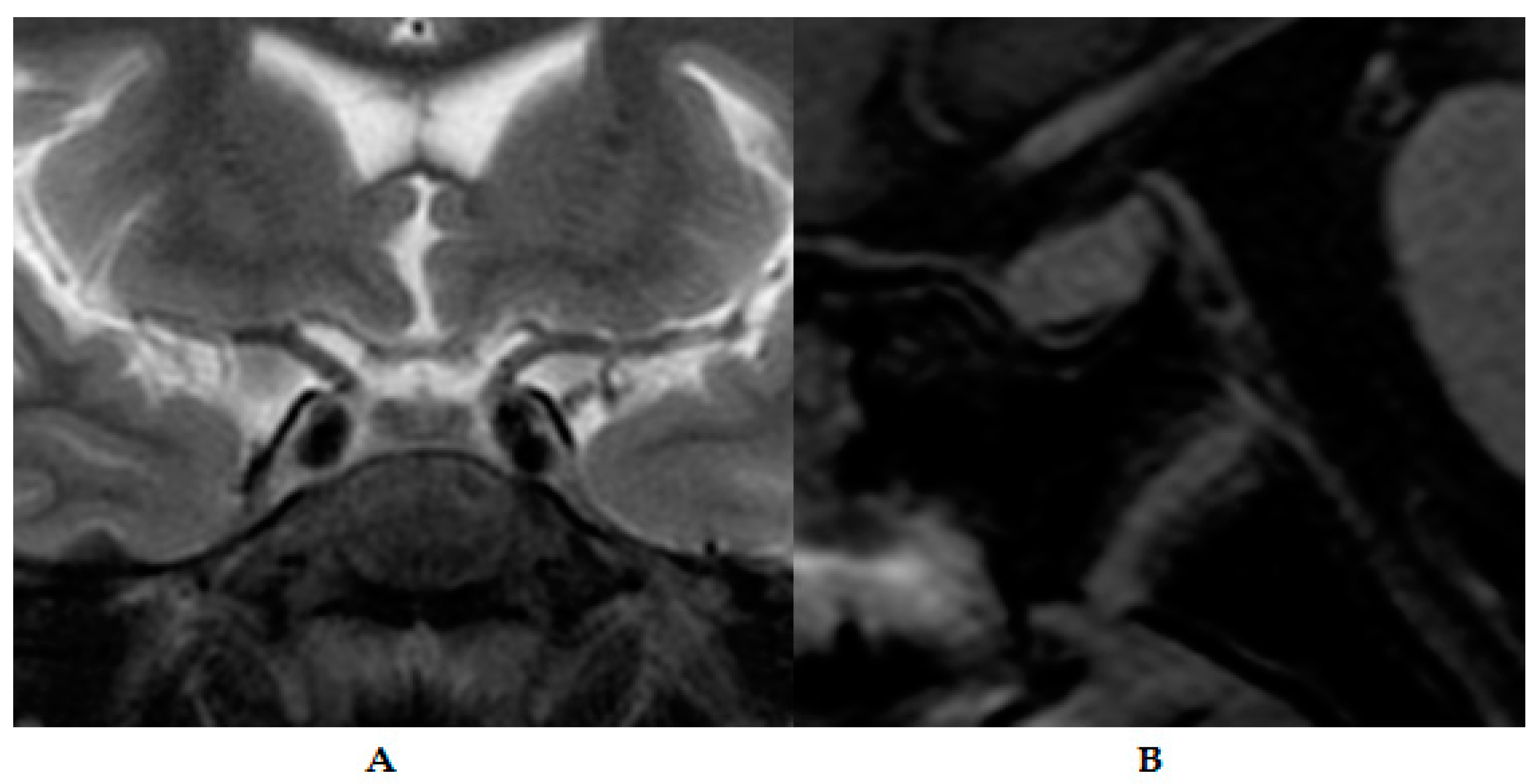 Medicina 60 00830 g003 Medicina 60 00830 g003