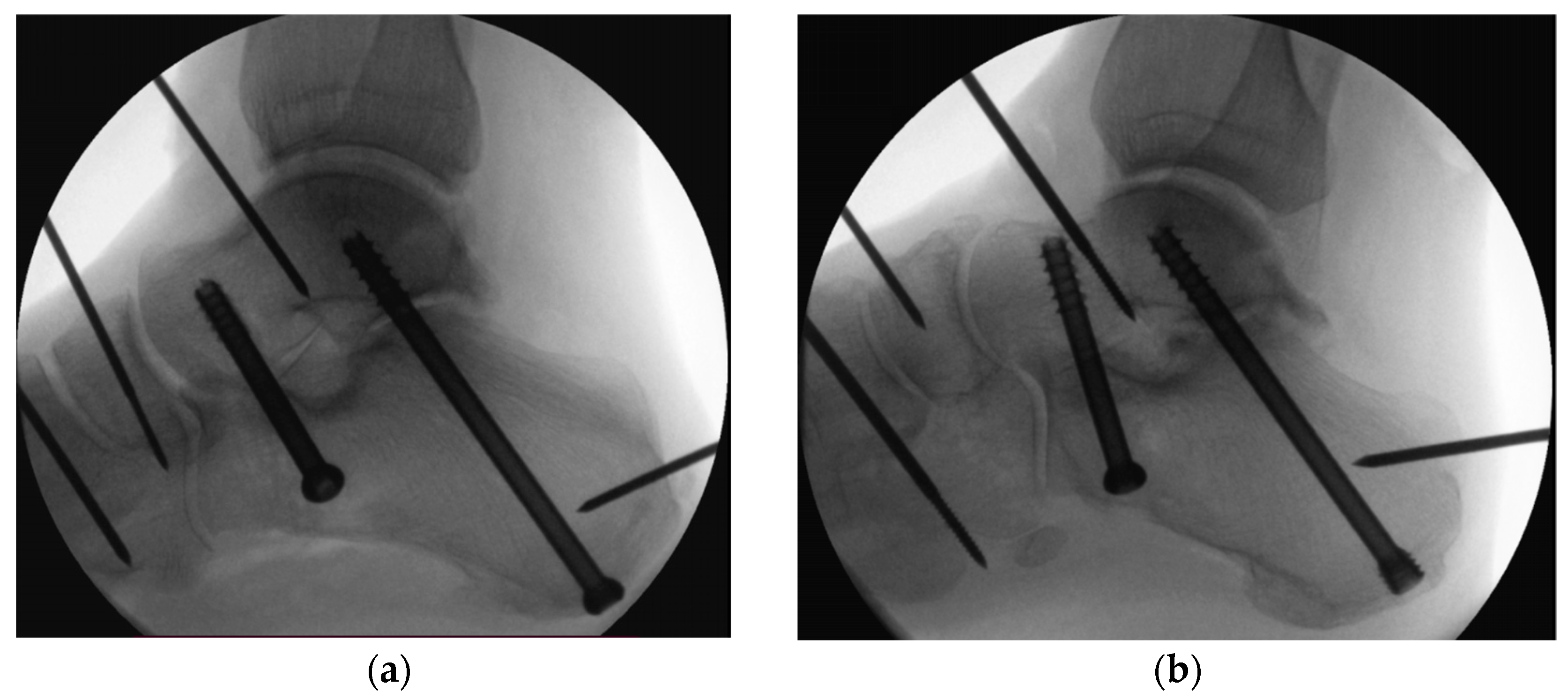 Medicina 60 00844 g005