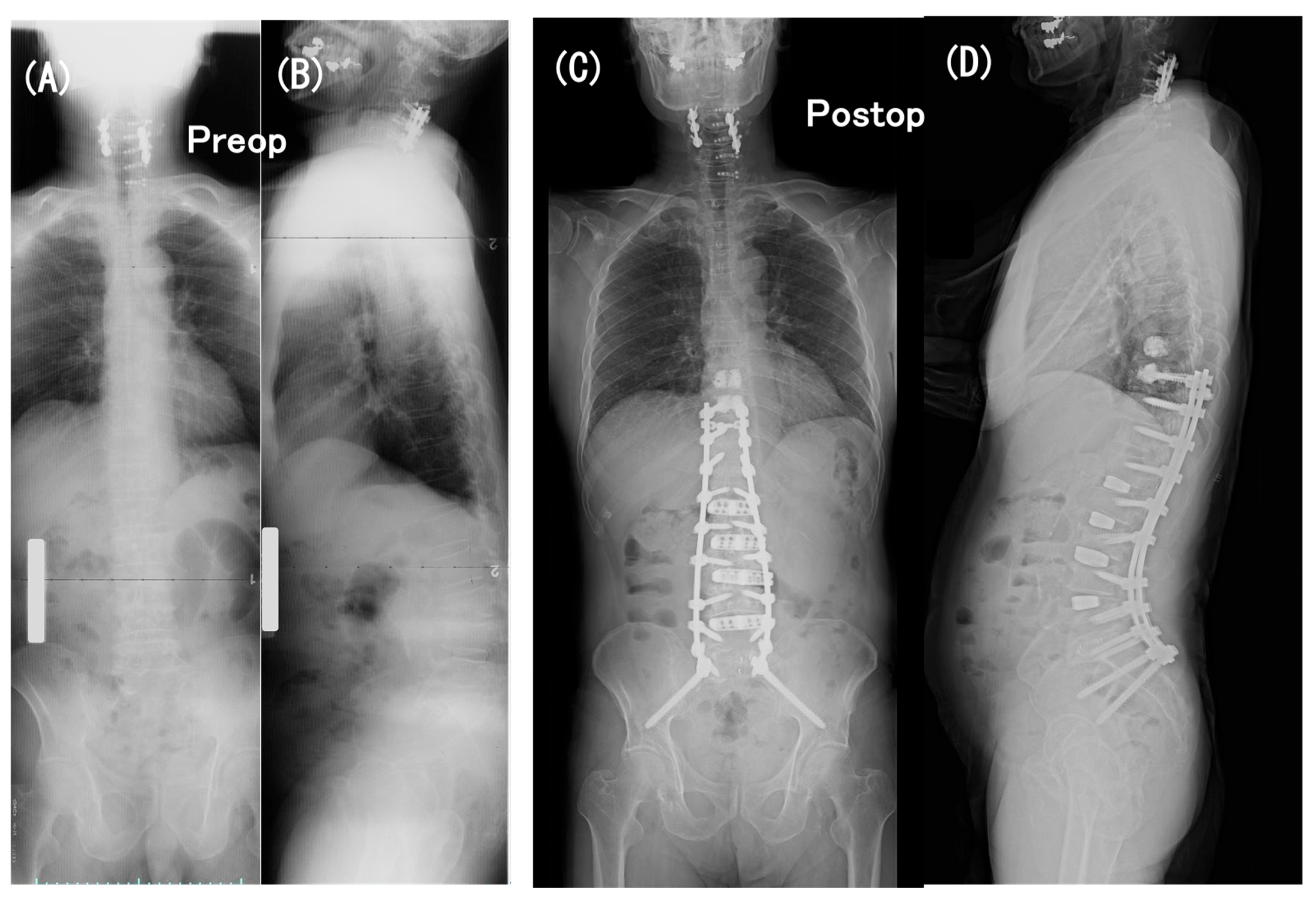 Medicina 60 00860 g006