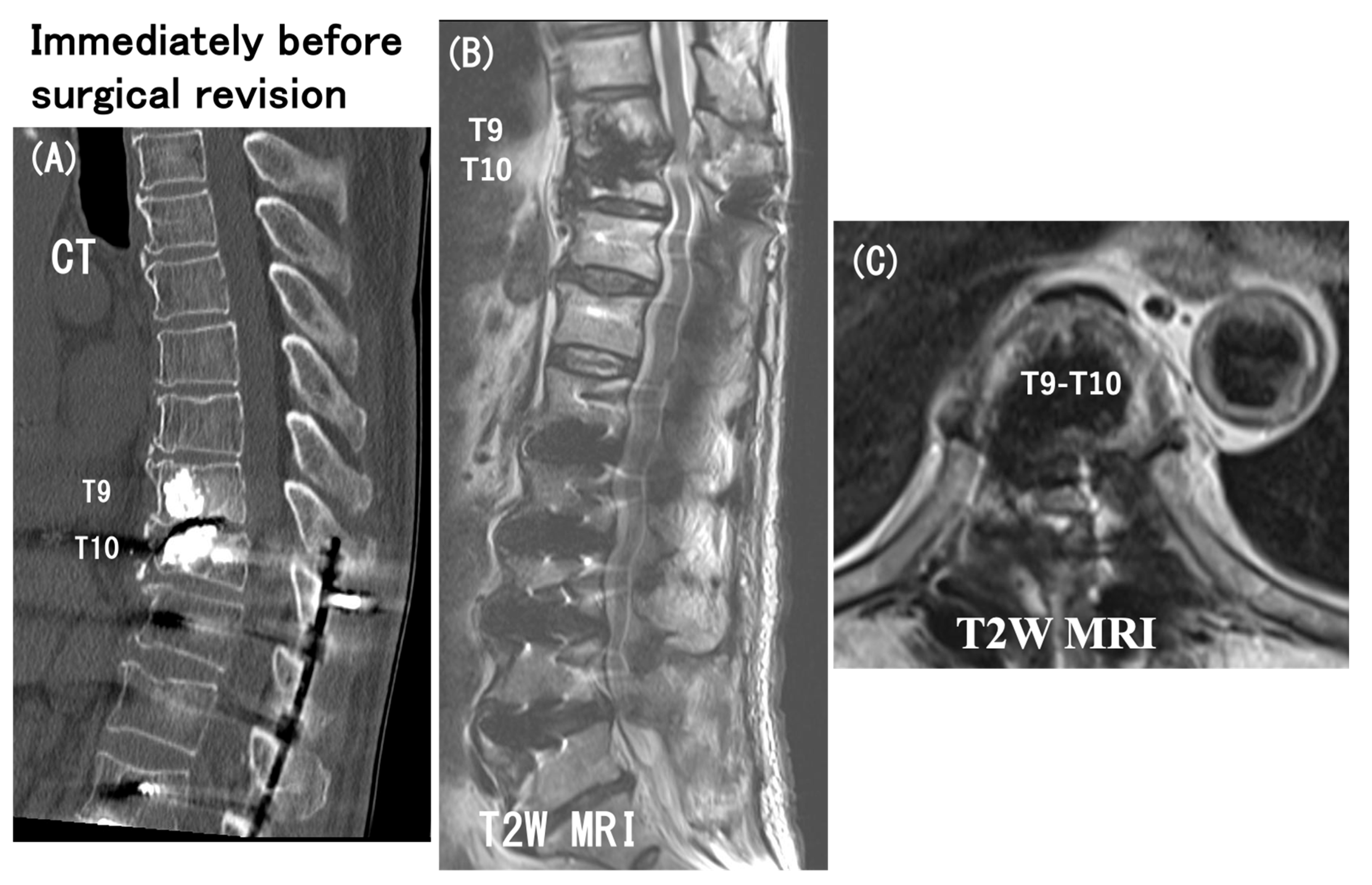 Medicina 60 00860 g008