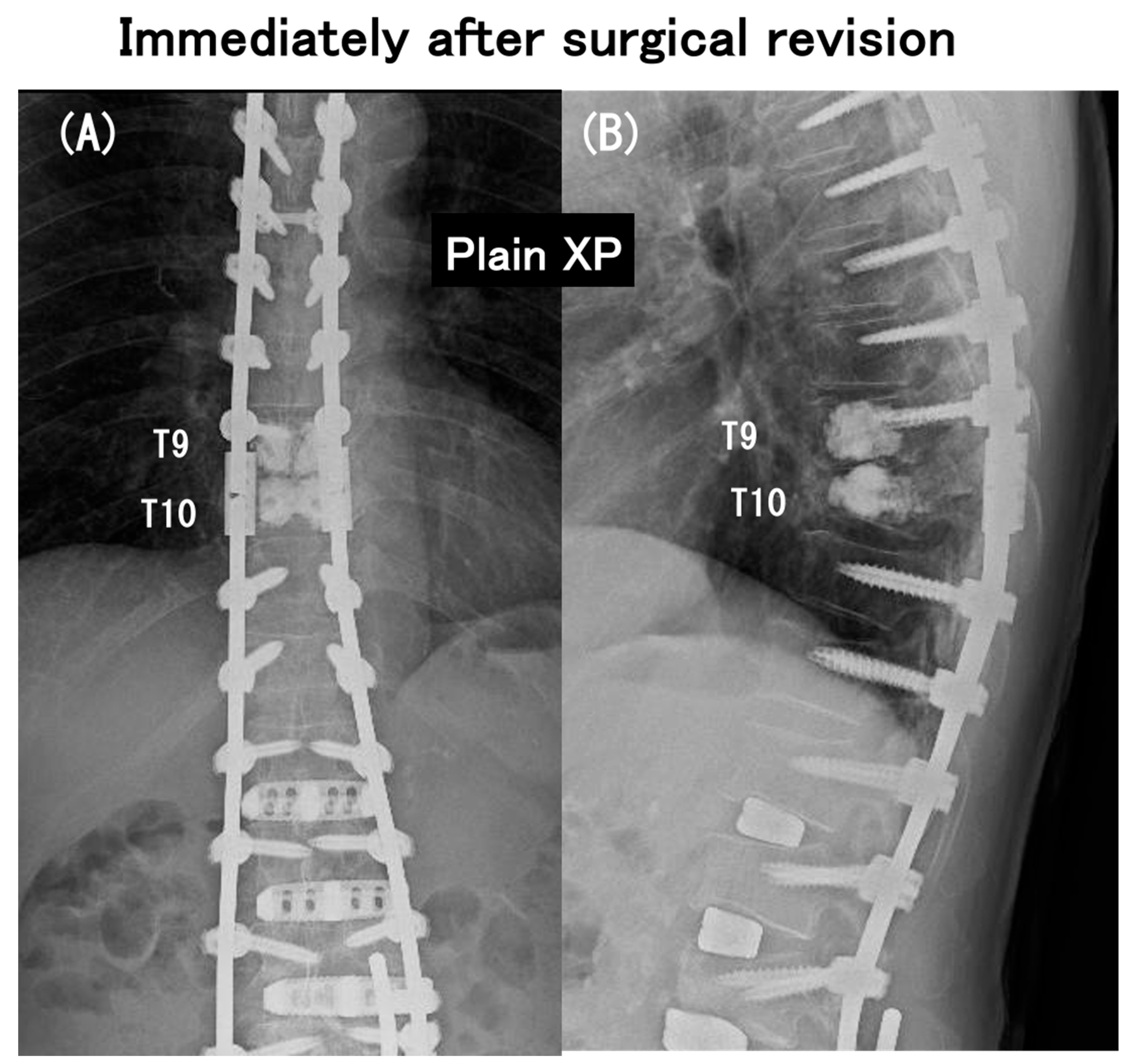 Medicina 60 00860 g009
