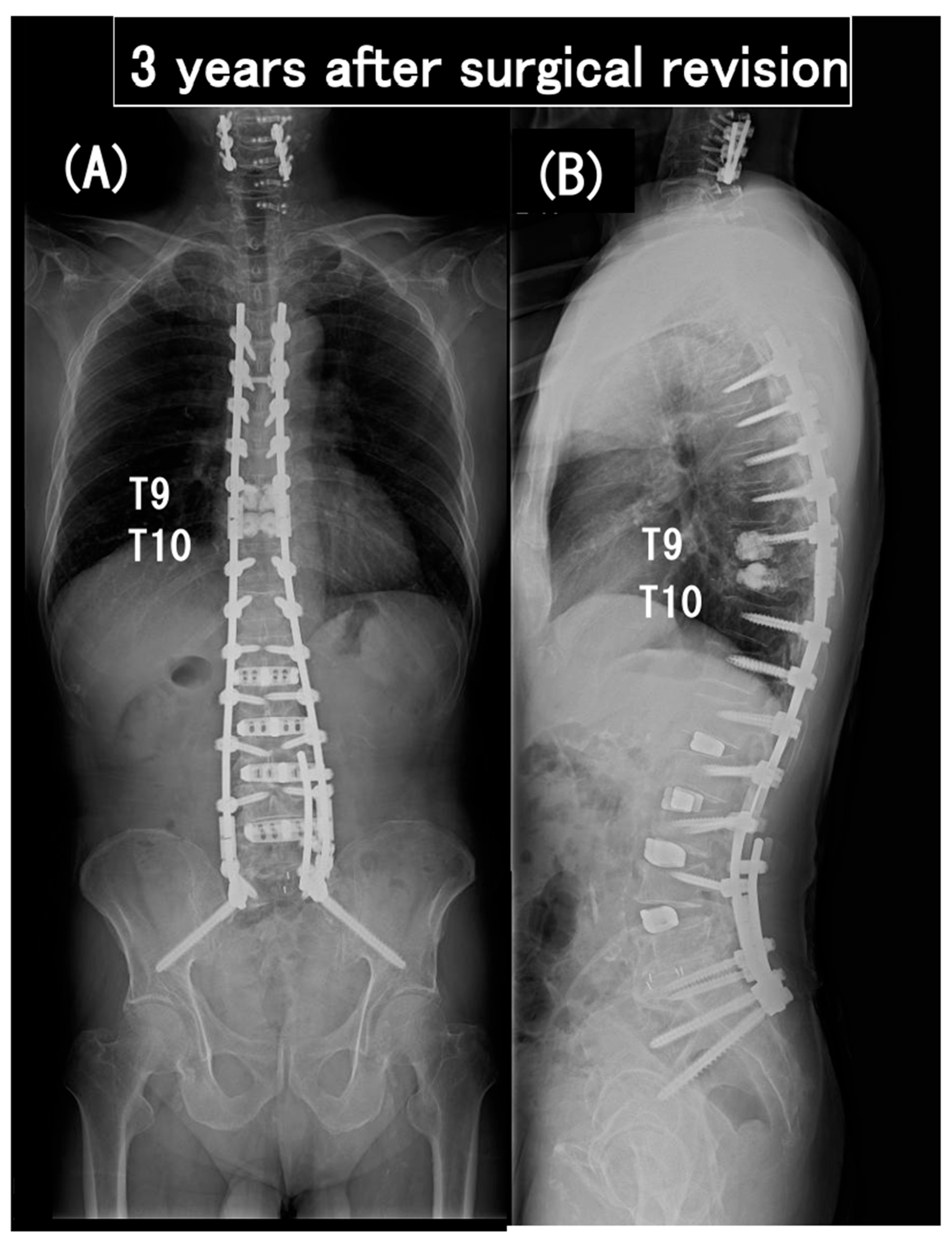 Medicina 60 00860 g010